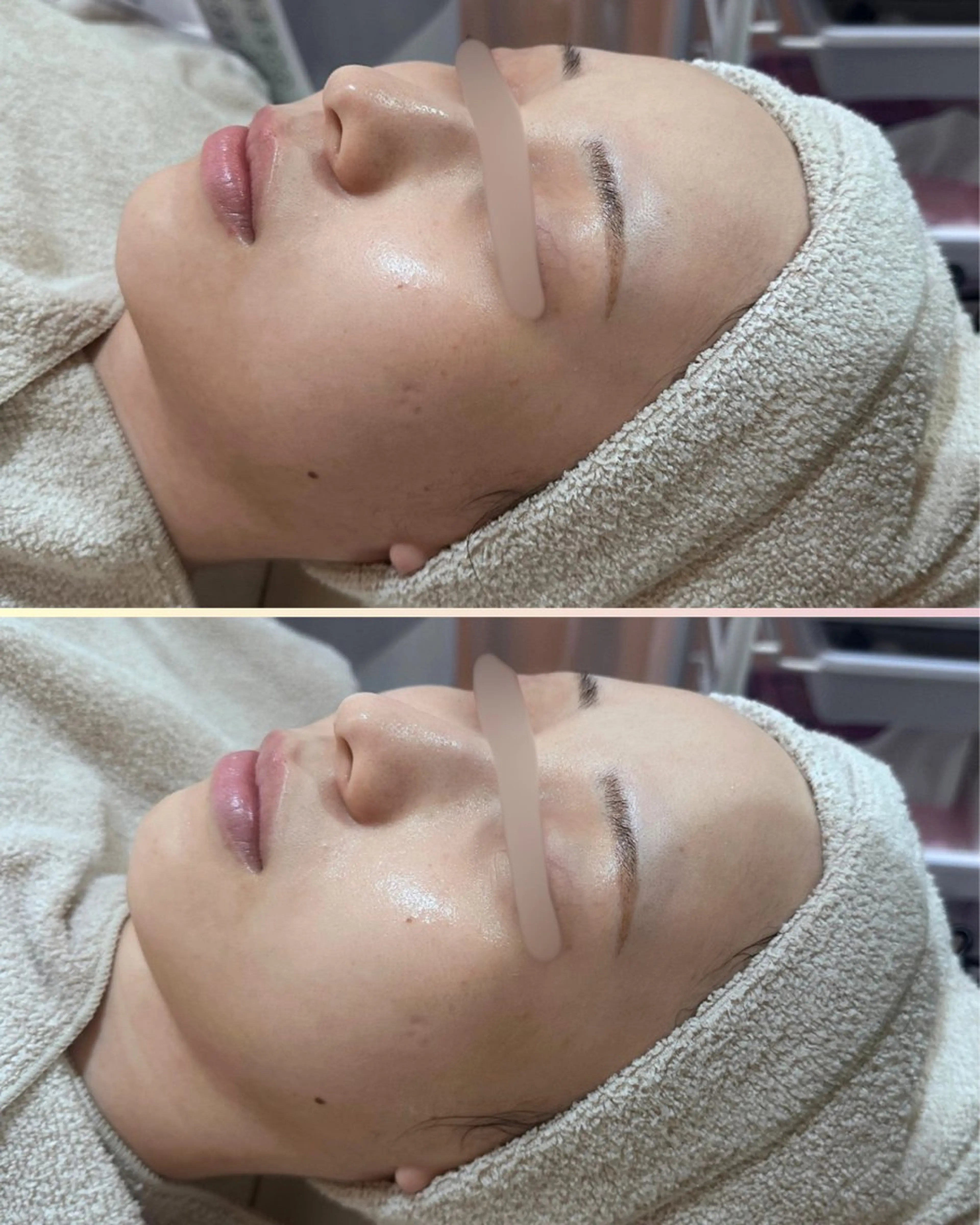 エステ |ピーリング・毛穴| soina神楽坂のエステ・リラクイメージ