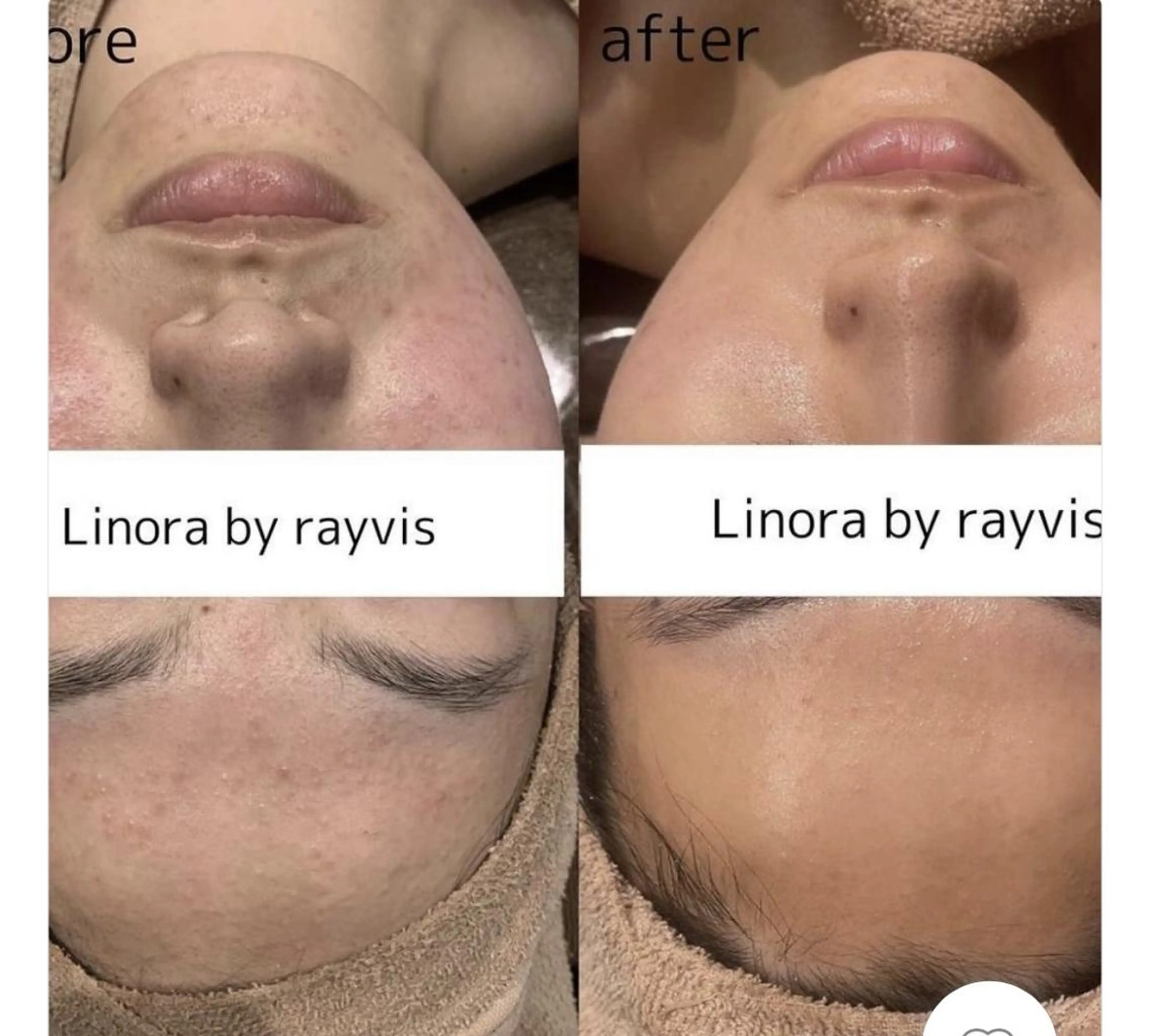 エステ 🌈Linora byRAYVIS🌈のエステ・リラクイメージ