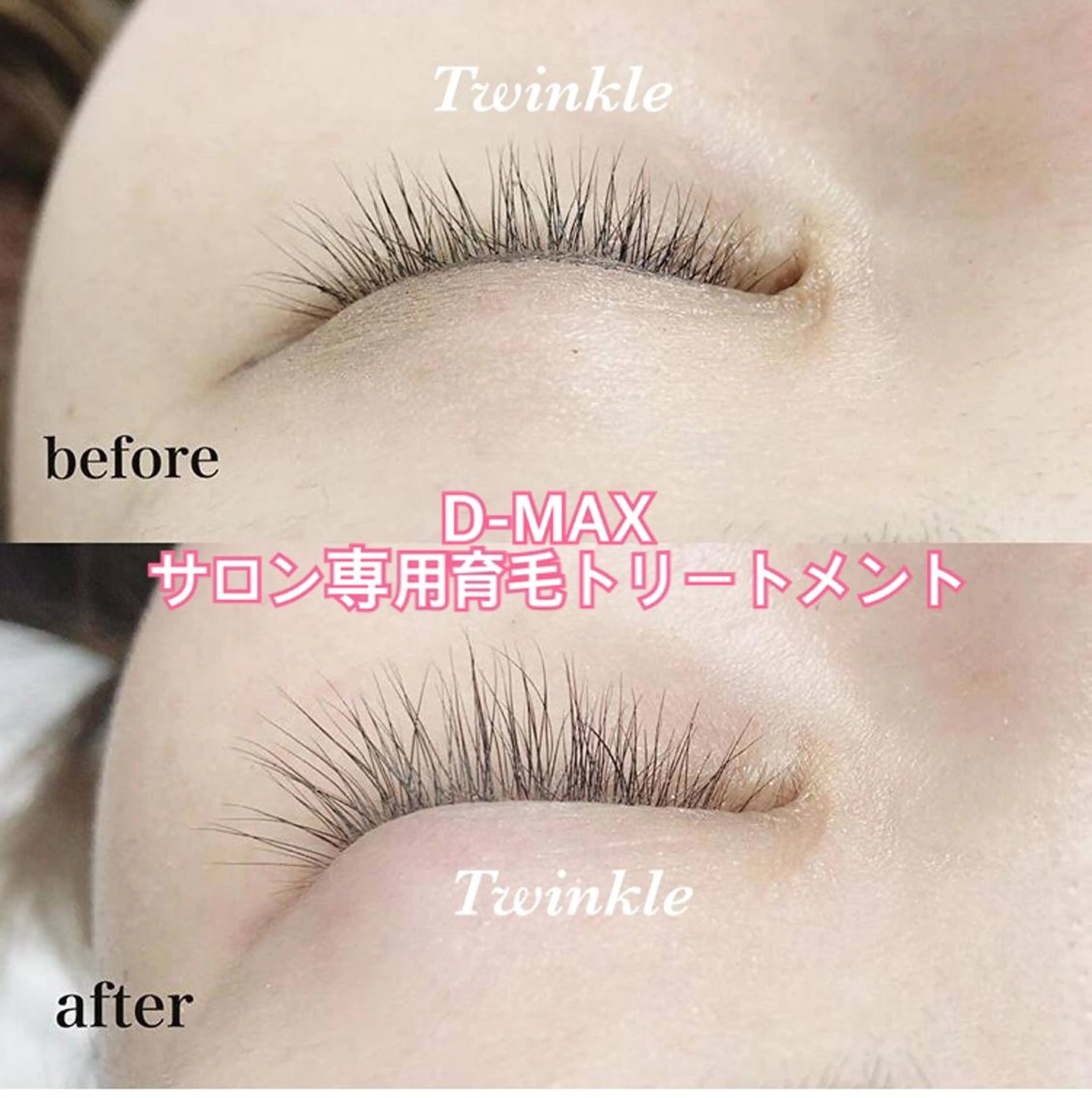 マツエク・マツパ twinkle所属・えみり 【Twinkle 】のマツエク・マツパデザイン