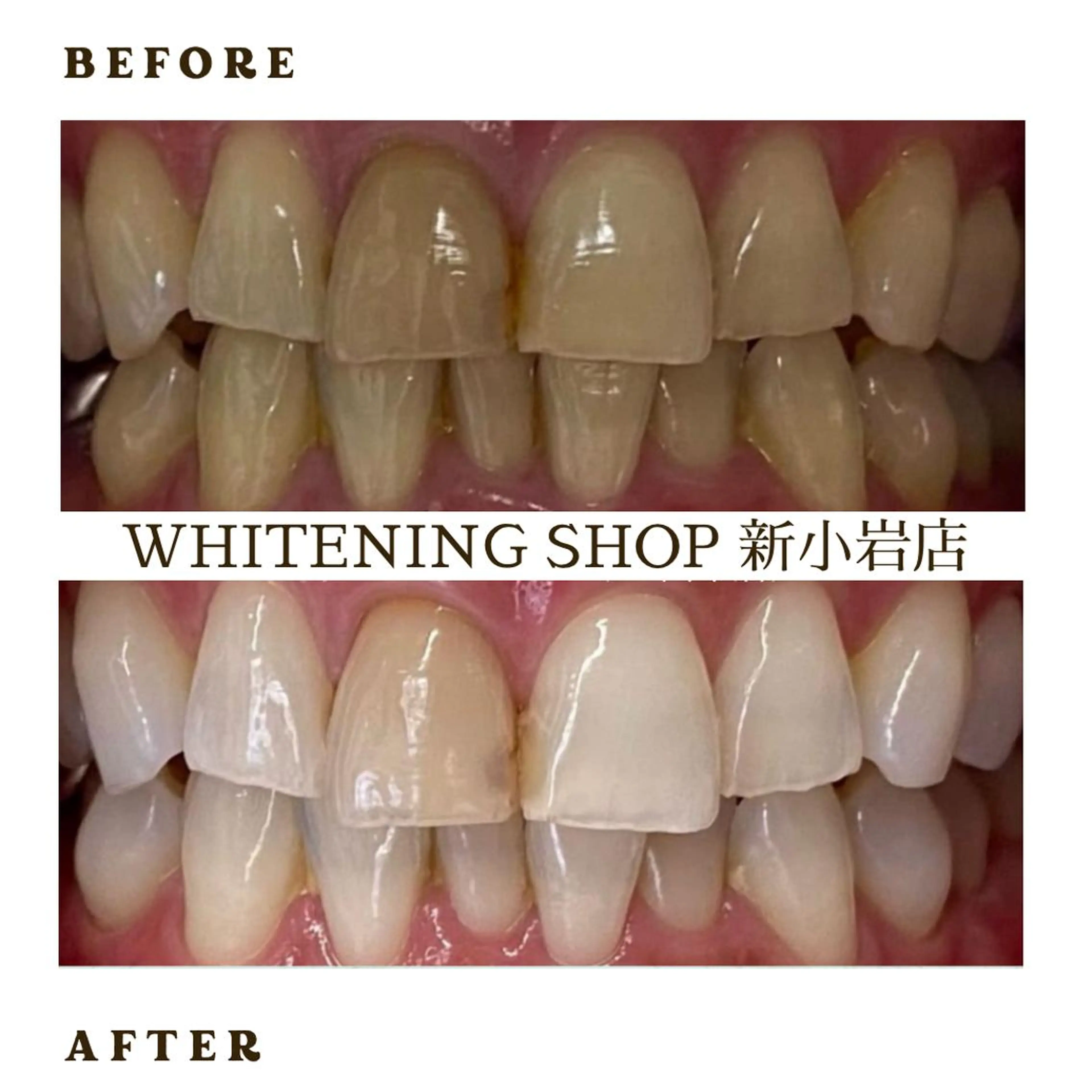 メンズ その他 ホワイトニング ショップ新小岩店のその他イメージ