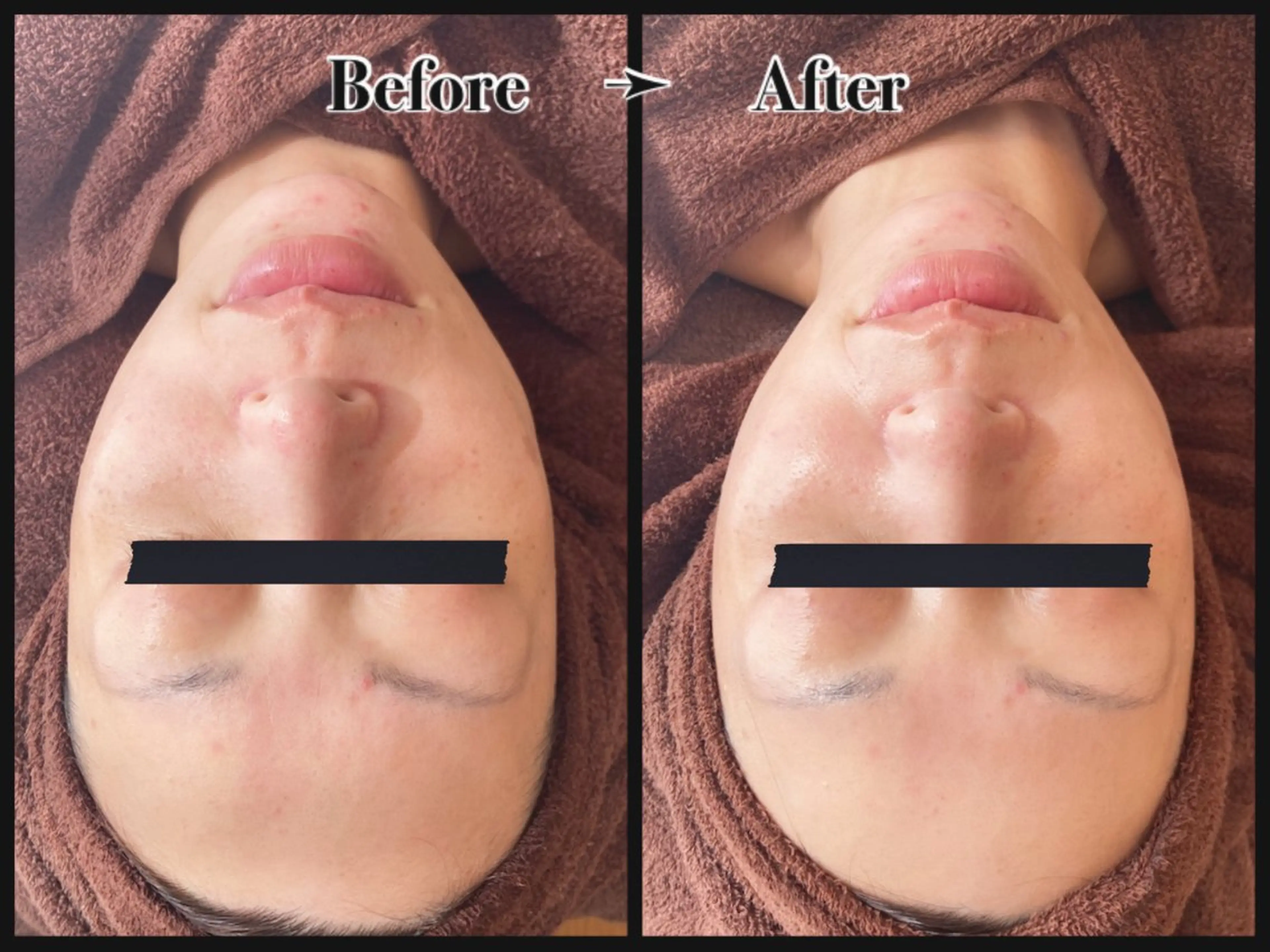 エステ リラク BELLÉ TRINITYのエステ・リラクイメージ