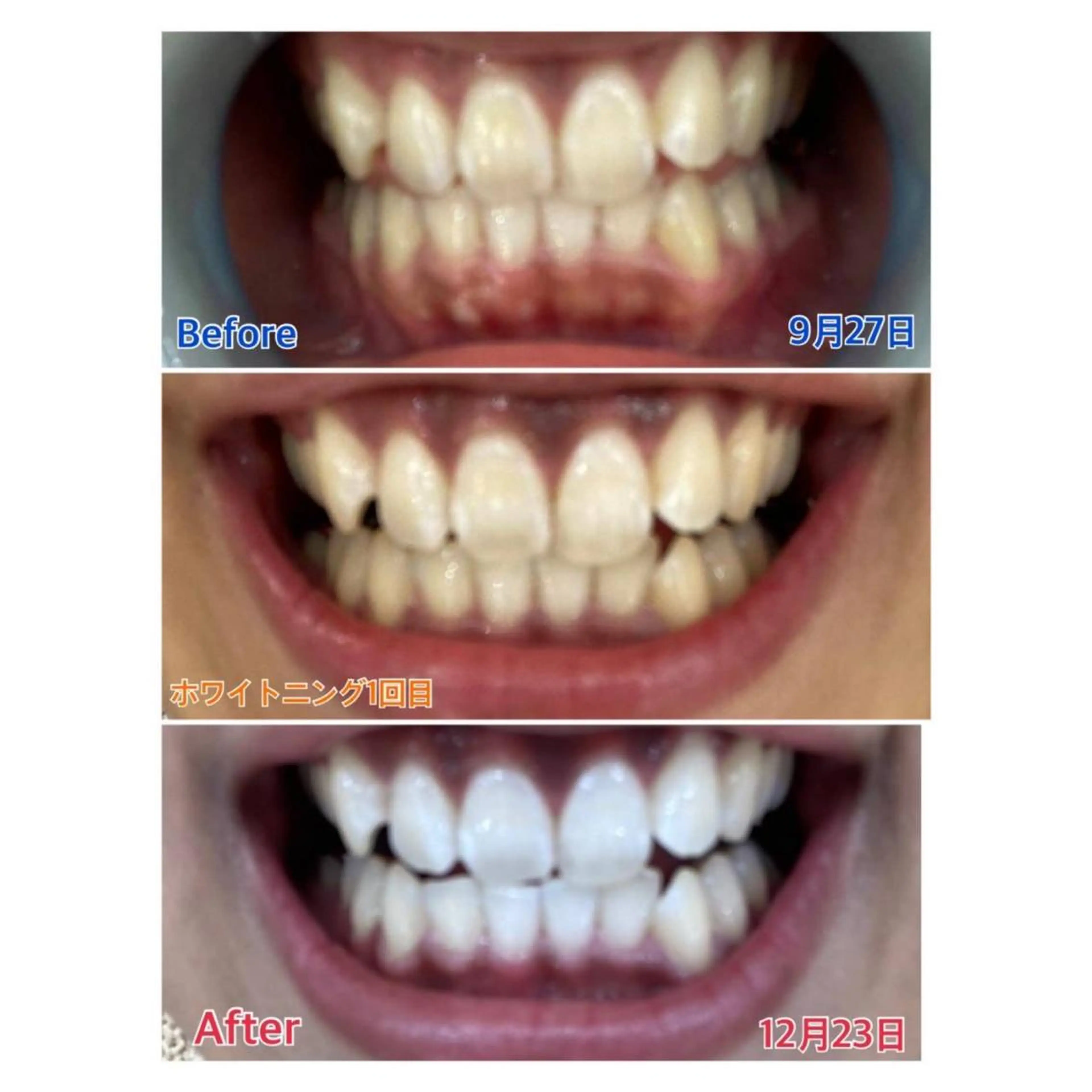 MBEAUTYSALON 千葉店・京成大久保所属・Melty 輝のその他イメージ