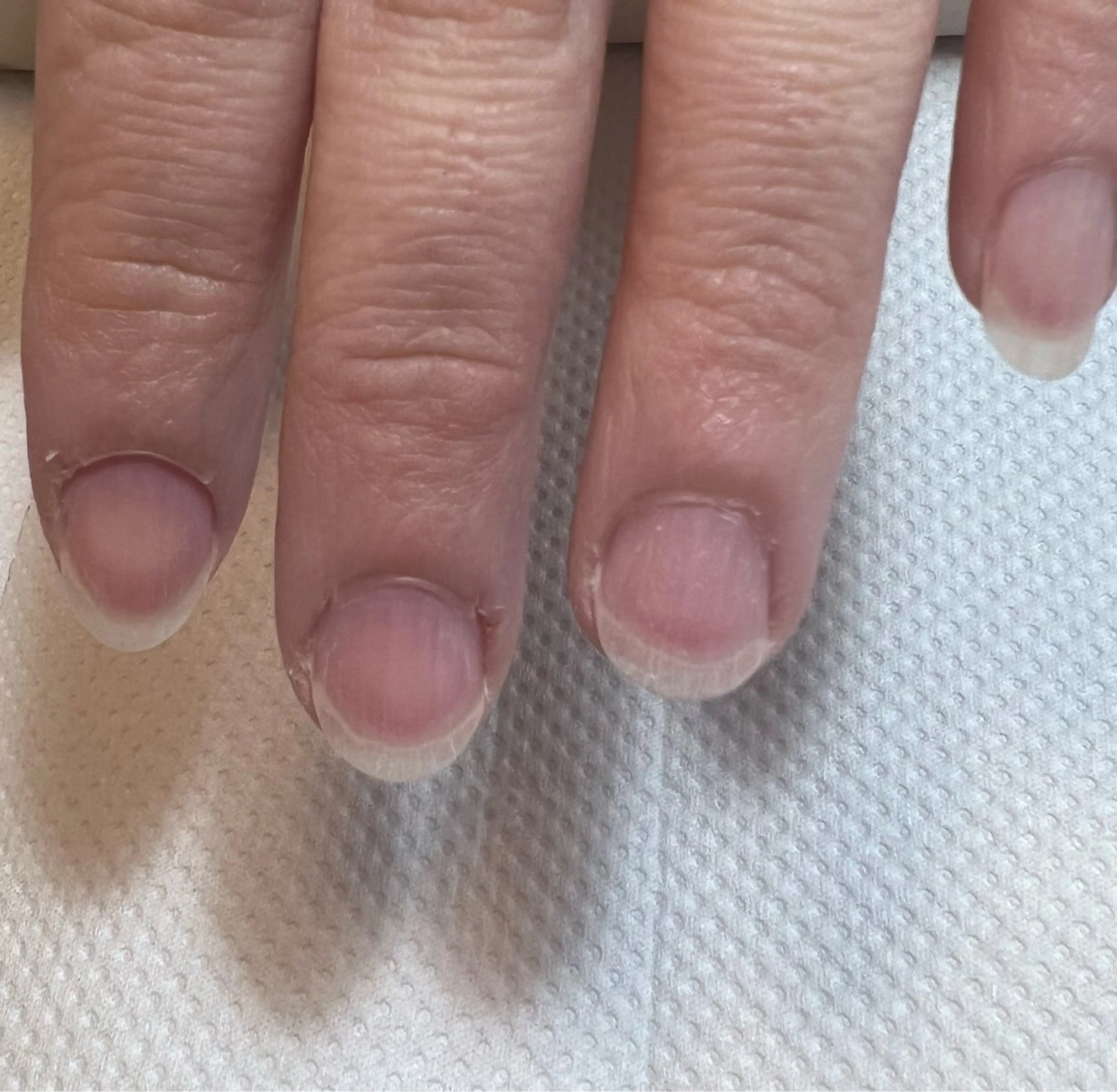 ネイル ハンドネイル ハンドケア 【爪の育成専門】深爪・むしり癖・丸い爪・ガサガサなど　　Rio nail所属・Rio nail まなみのネイルデザイン