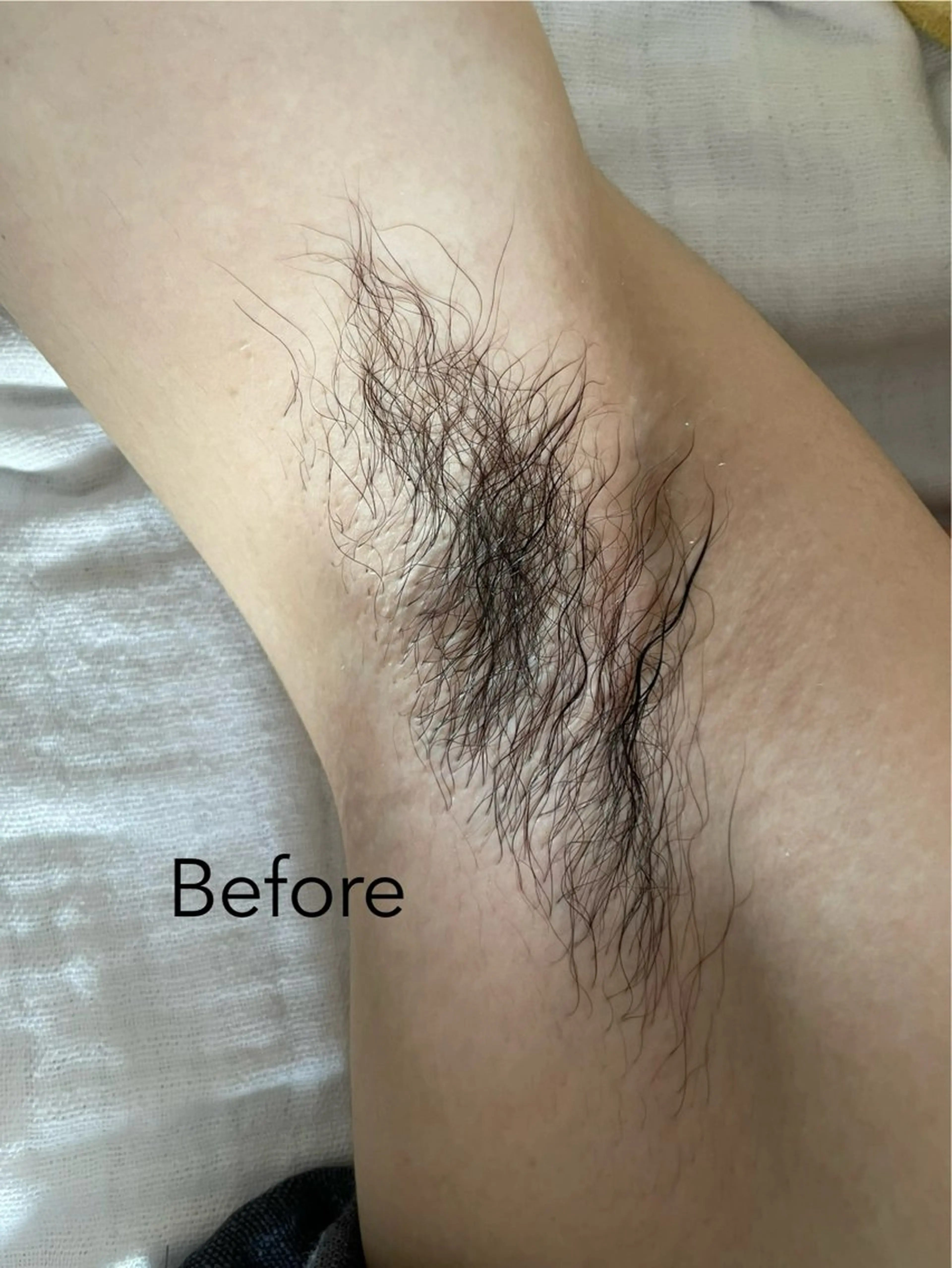 une所属・une シュガーリング脱毛のエステ・リラクイメージ