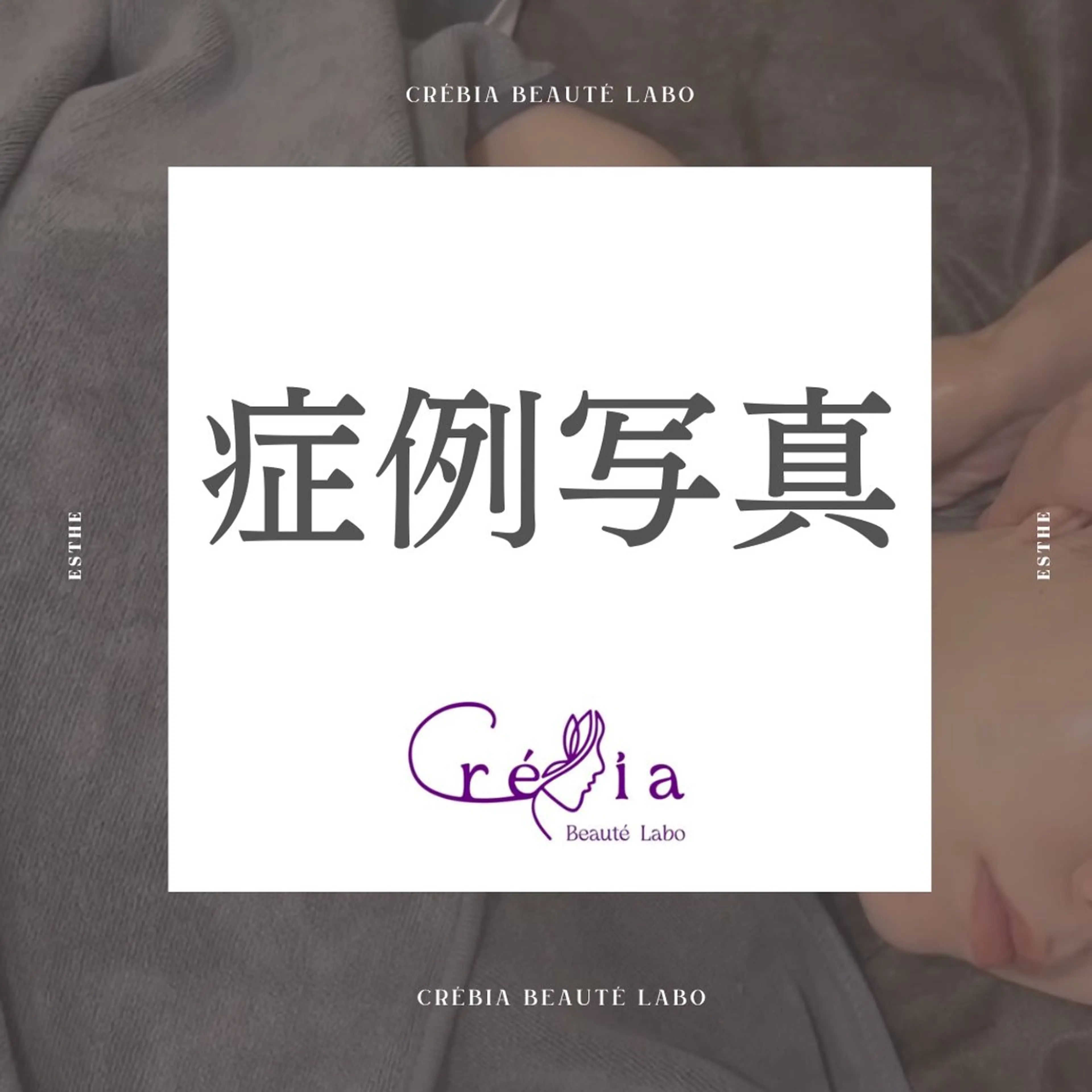 小顔＆まつ毛サロン AKANE❤️のエステ・リラクイメージ