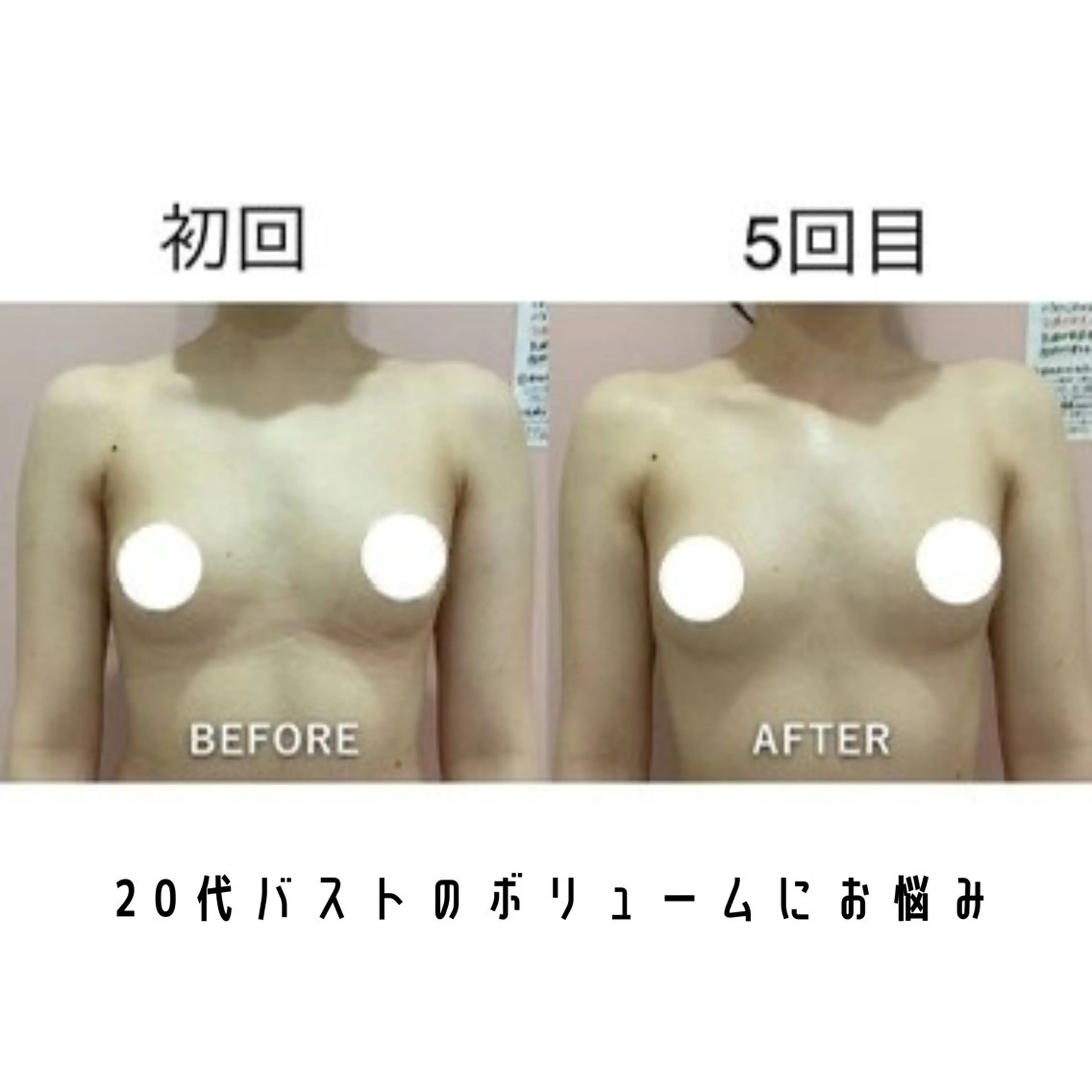 【痩身/ダイエット】 オーバイワン横浜🍓のエステ・リラクイメージ