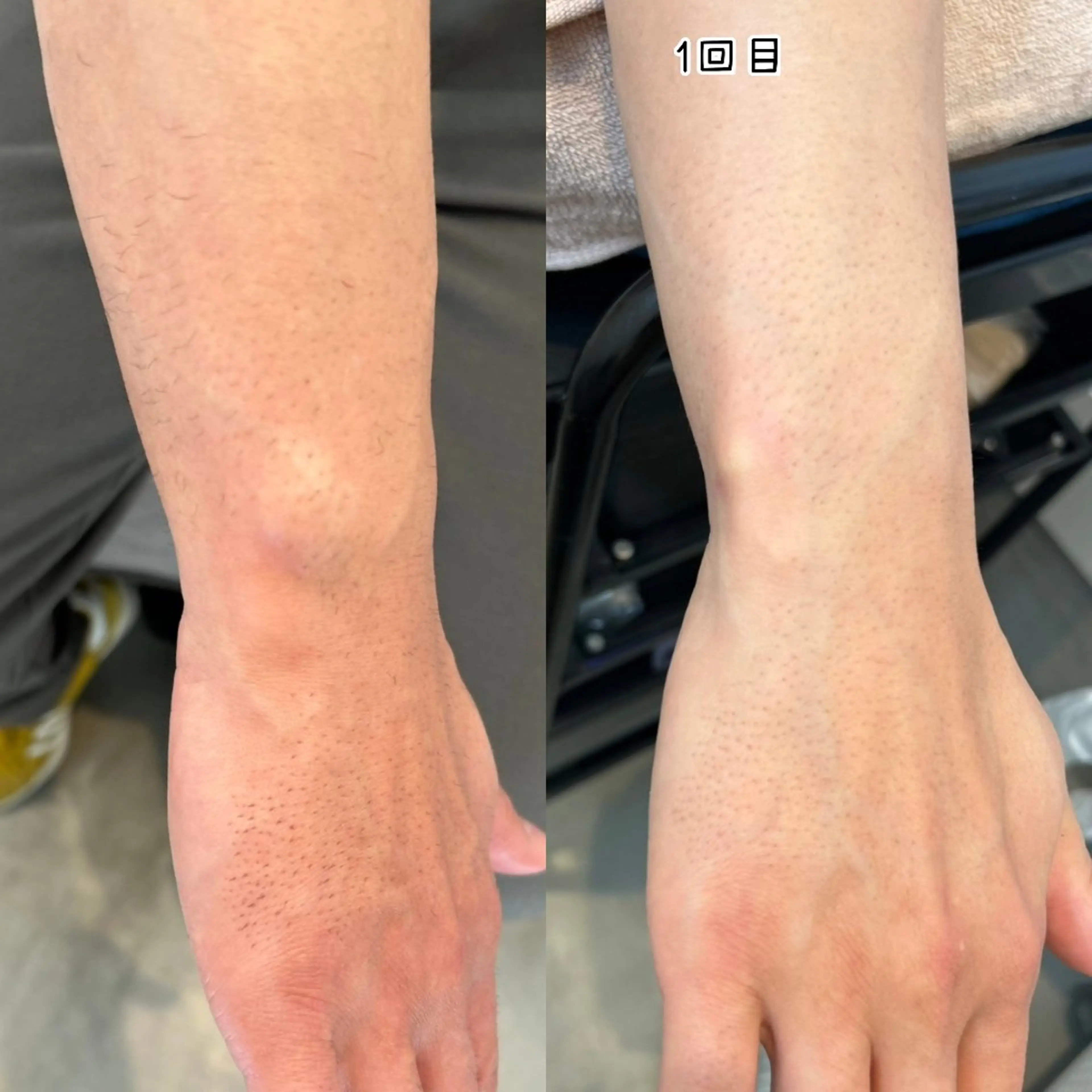 脱毛 Plaire Hair Design所属・Plaire エステのエステ・リラクイメージ