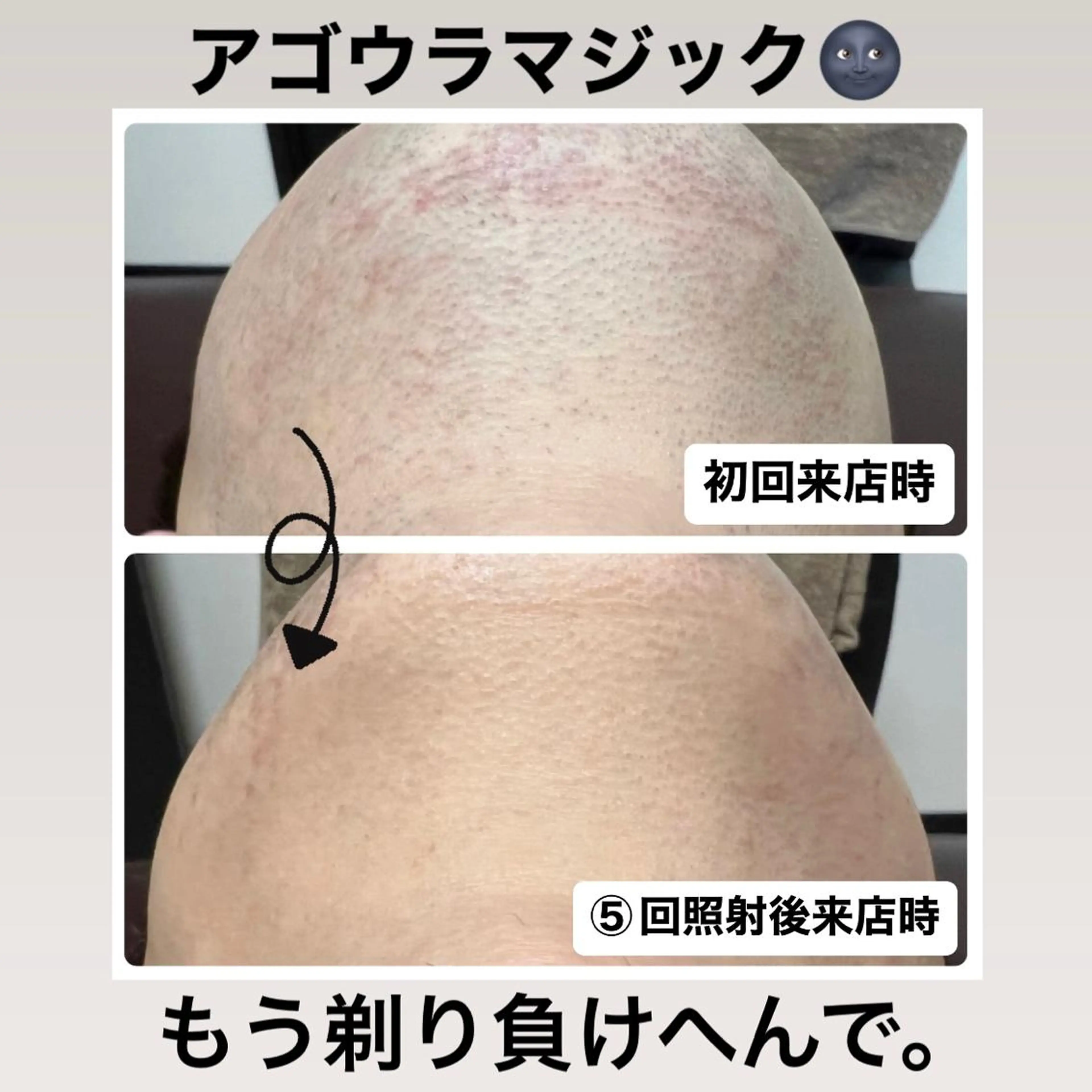 メンズ メンズハイライト メンズ脱毛サロン Le falcoのエステ・リラクイメージ