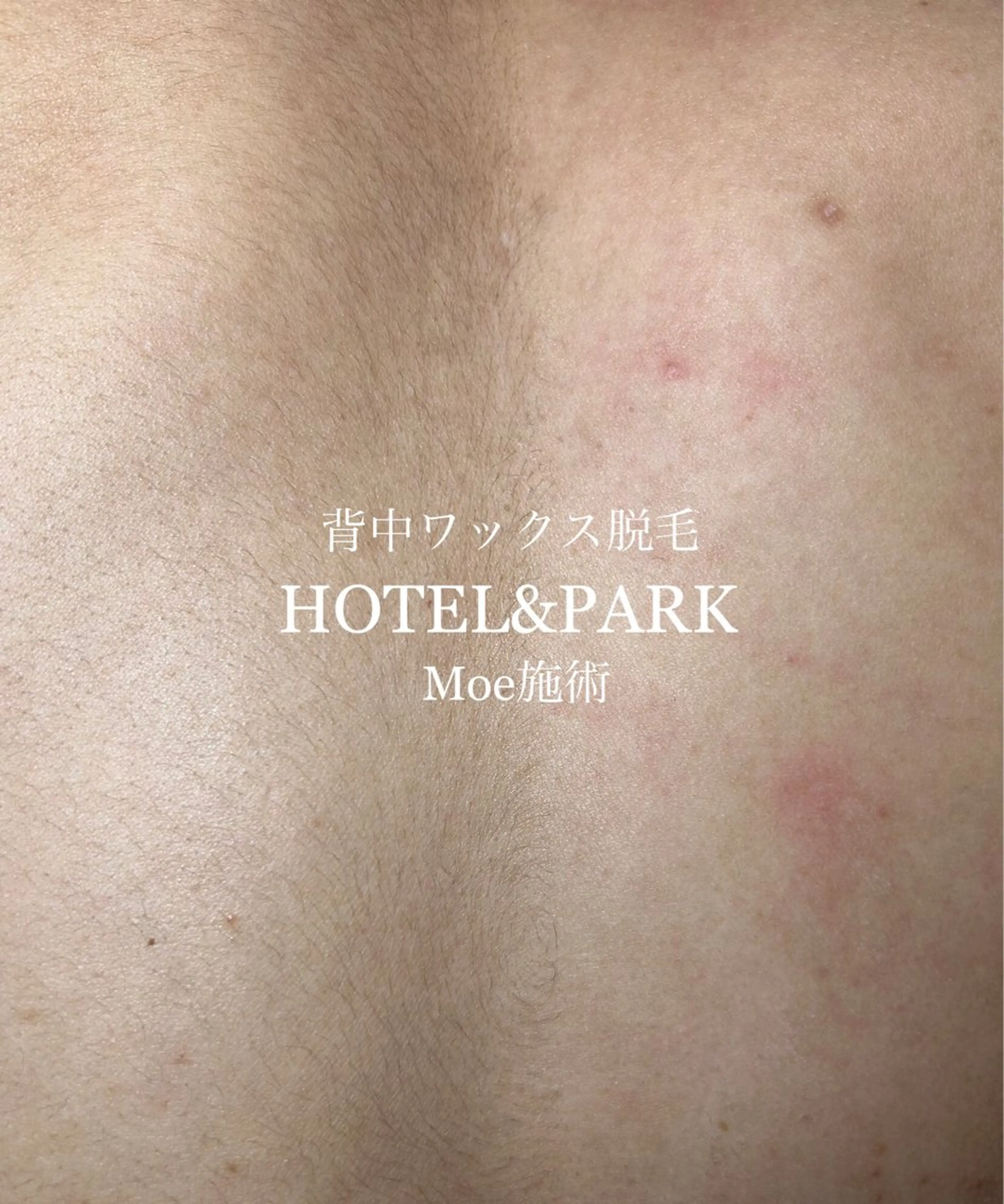HOTEL&PARK . ワックス脱毛のエステ・リラクイメージ
