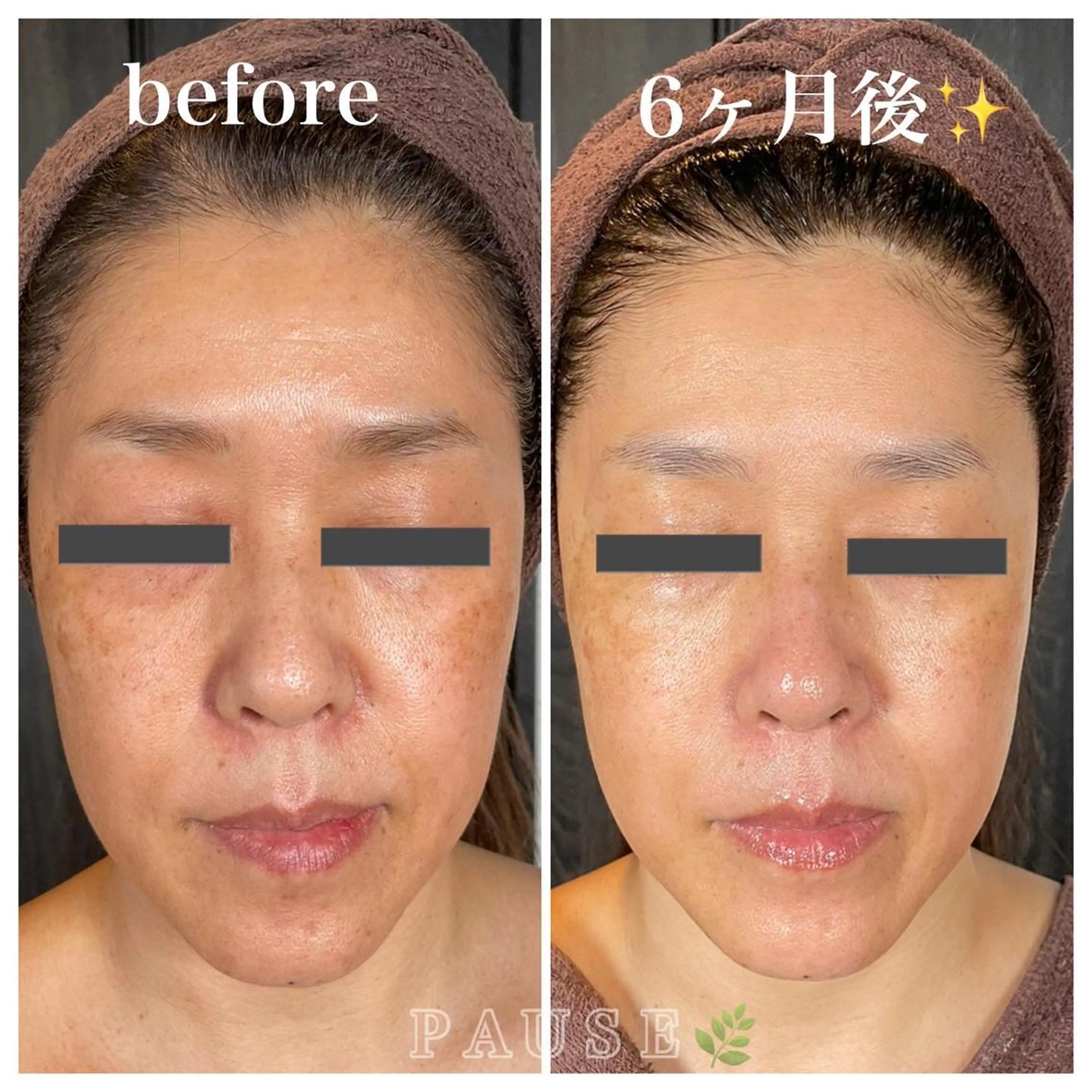 エステ 浜野 恵美のエステ・リラクイメージ