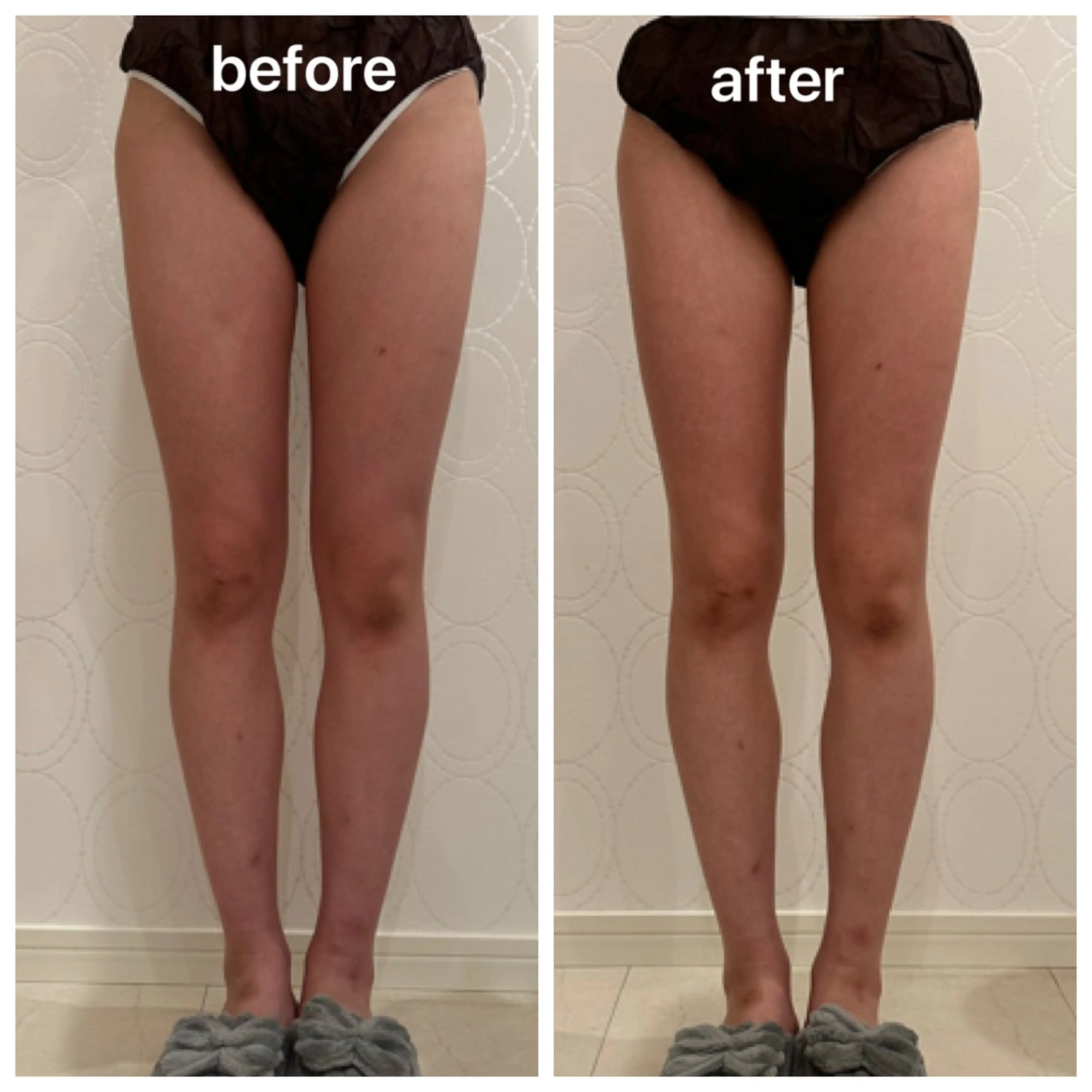 エステ トータルビューティ サロンstageのエステ・リラクイメージ