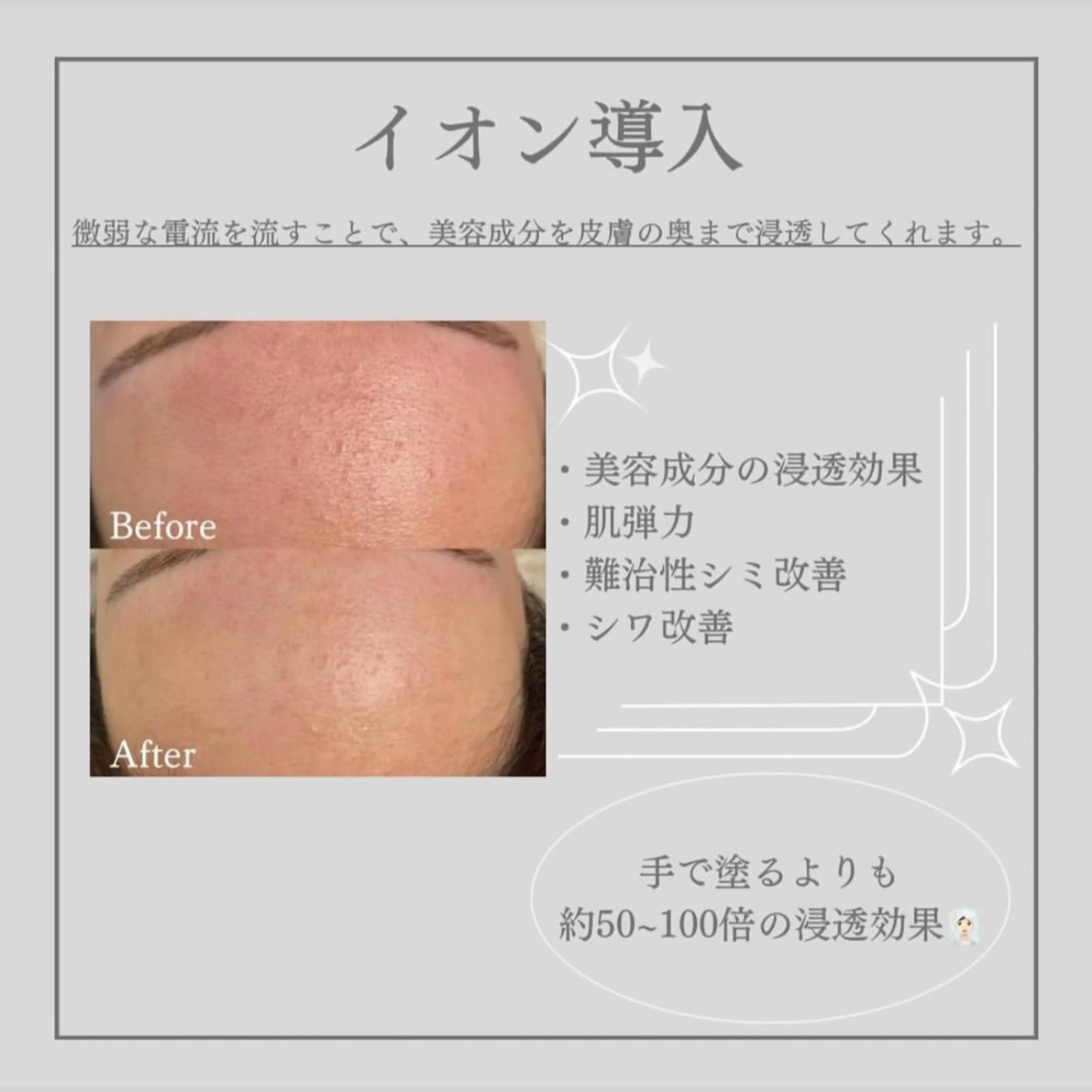 ツルツル卵肌に◎ゴマージュ+モデリングパック♪の写真