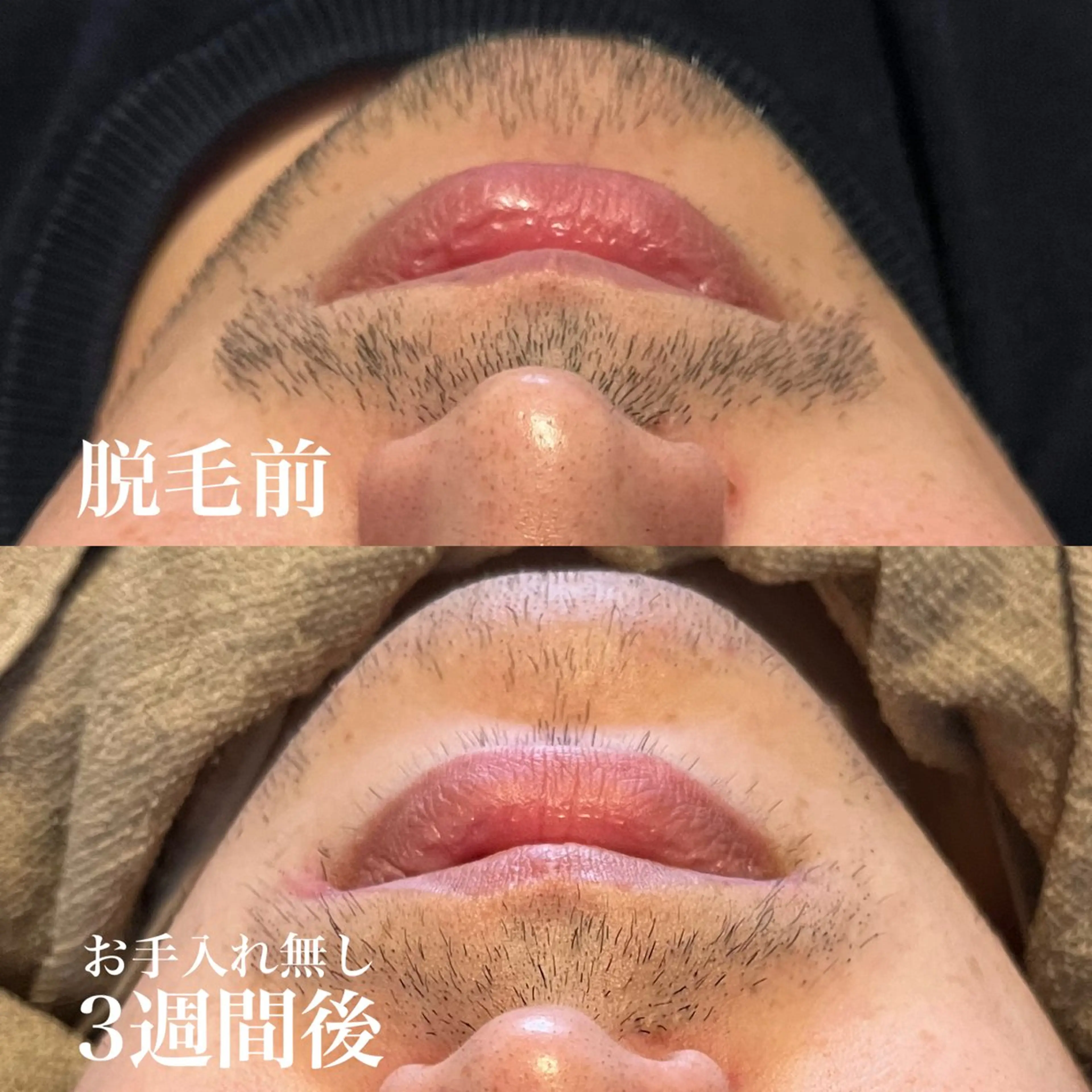 メンズ wax脱毛専門店 ハイラントのエステ・リラクイメージ