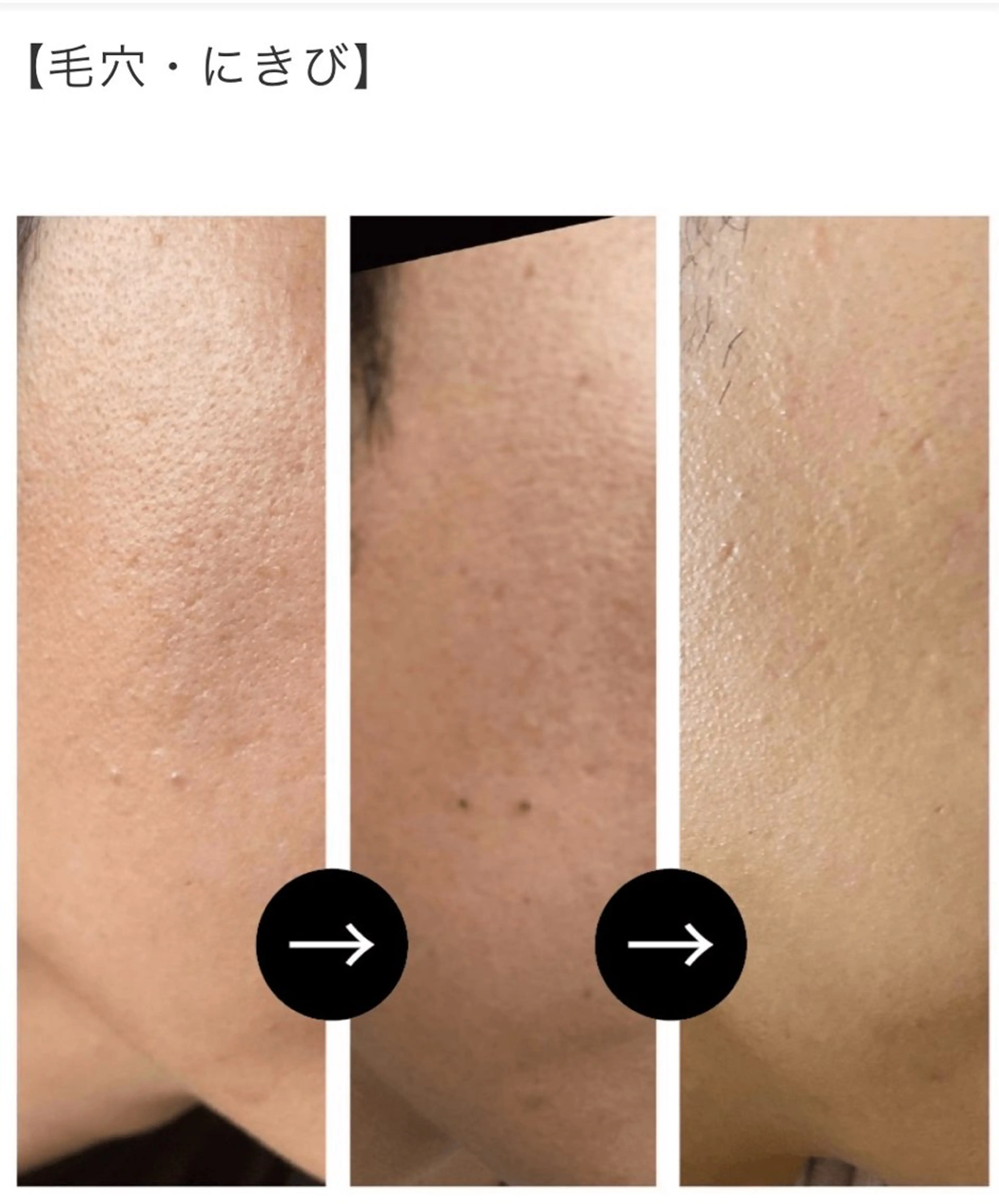 エレガンテ　ビューティーサロン所属・🎀エレガンテ🎀 美肌専門👸本間のその他イメージ