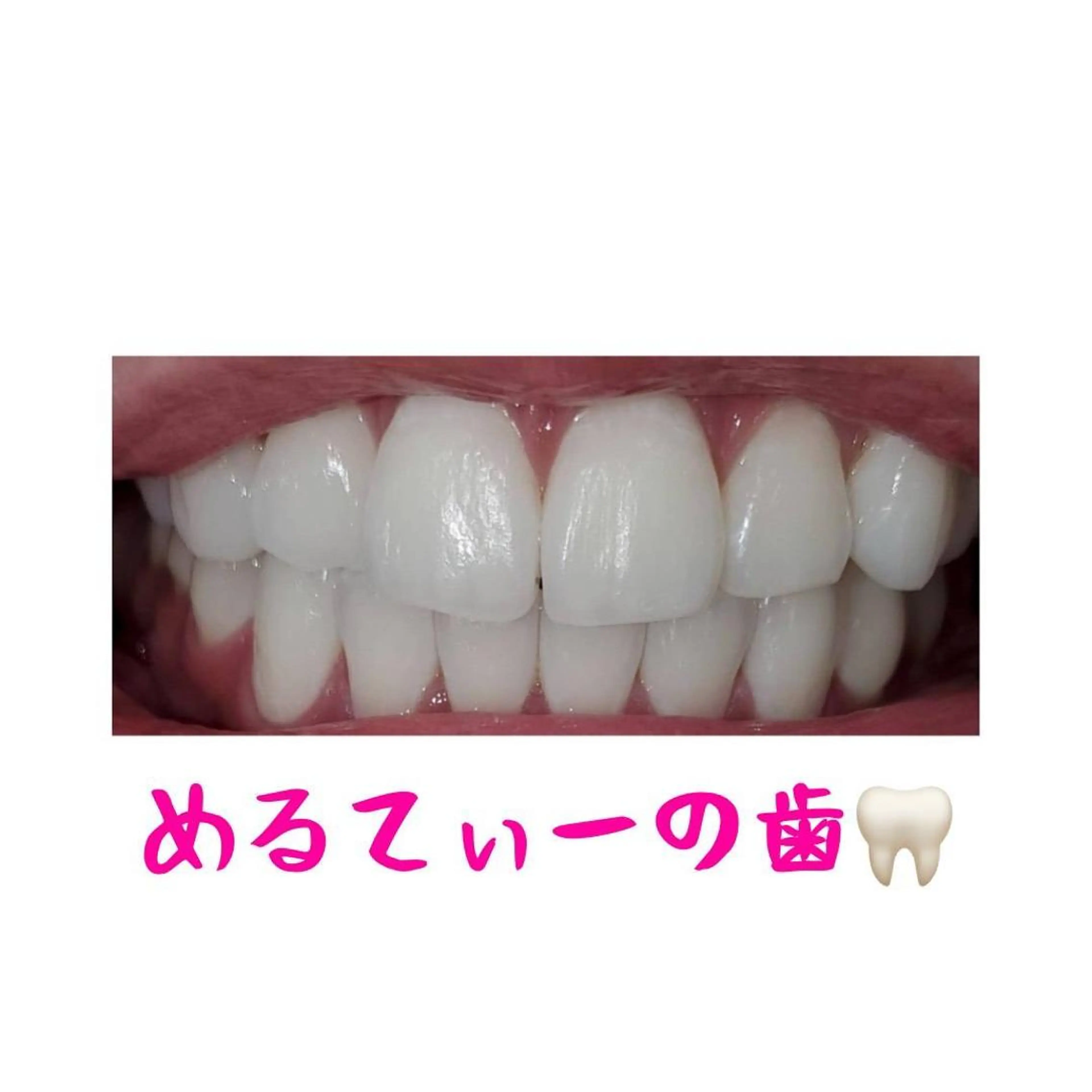 MBEAUTYSALON 千葉店・京成大久保所属・Melty 輝のその他イメージ