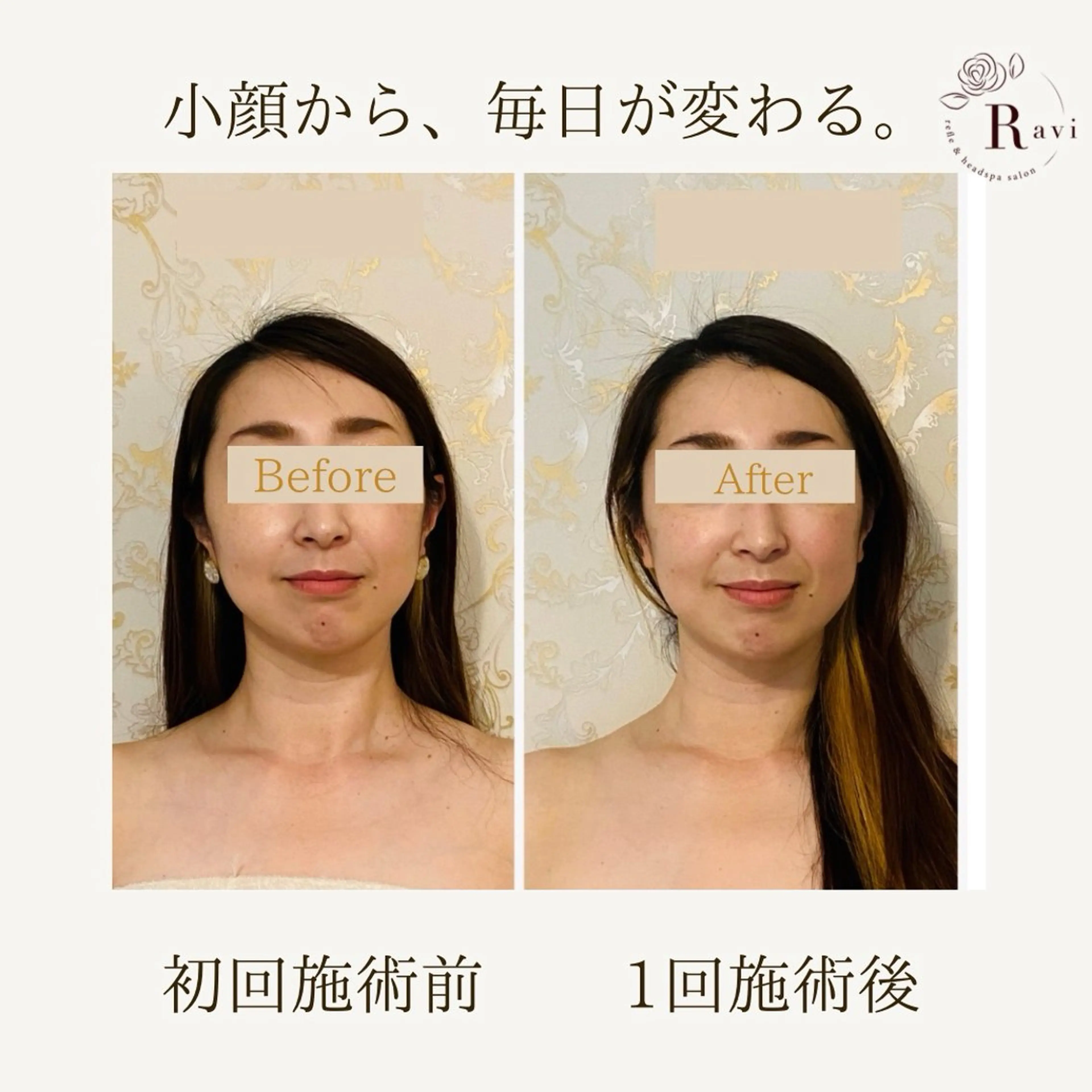 小顔サロンラヴィ　　船橋馬込沢店所属・小顔サロンラヴィ 船橋のエステ・リラクイメージ