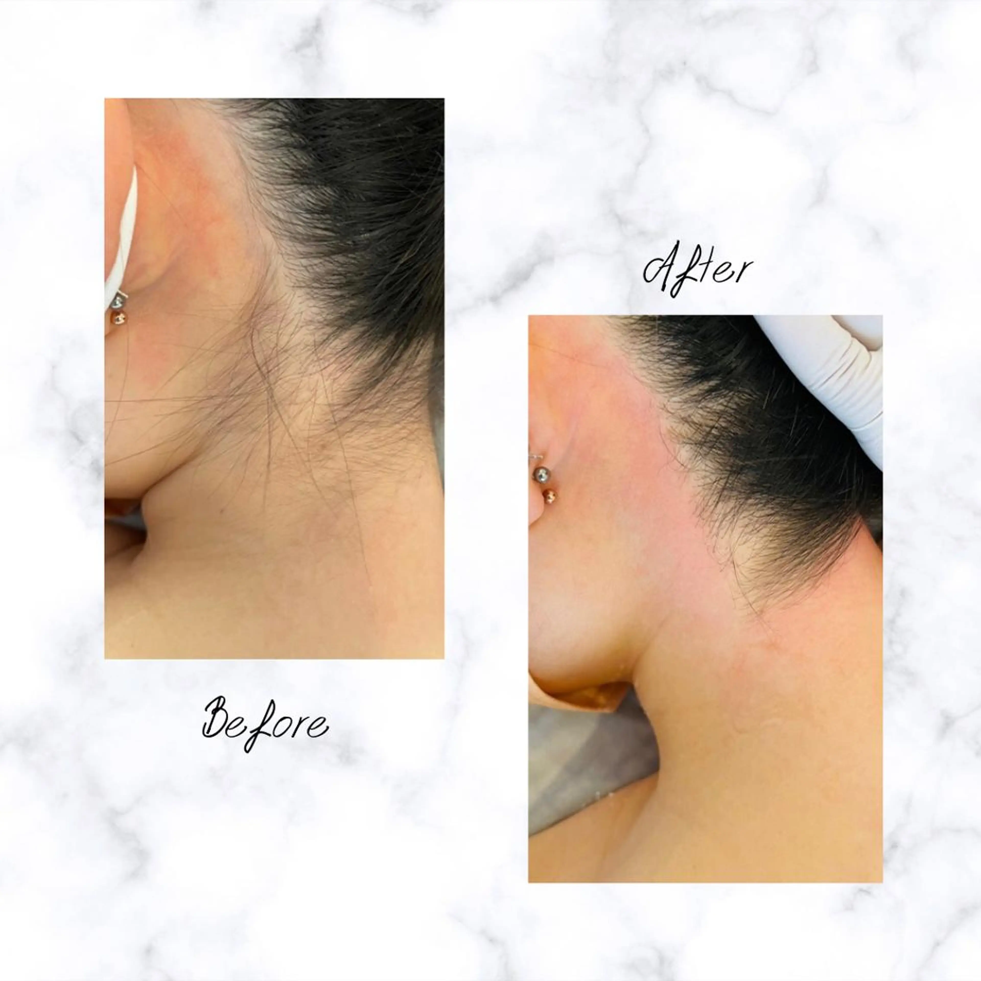 Cielo 上野店のエステ・リラクイメージ