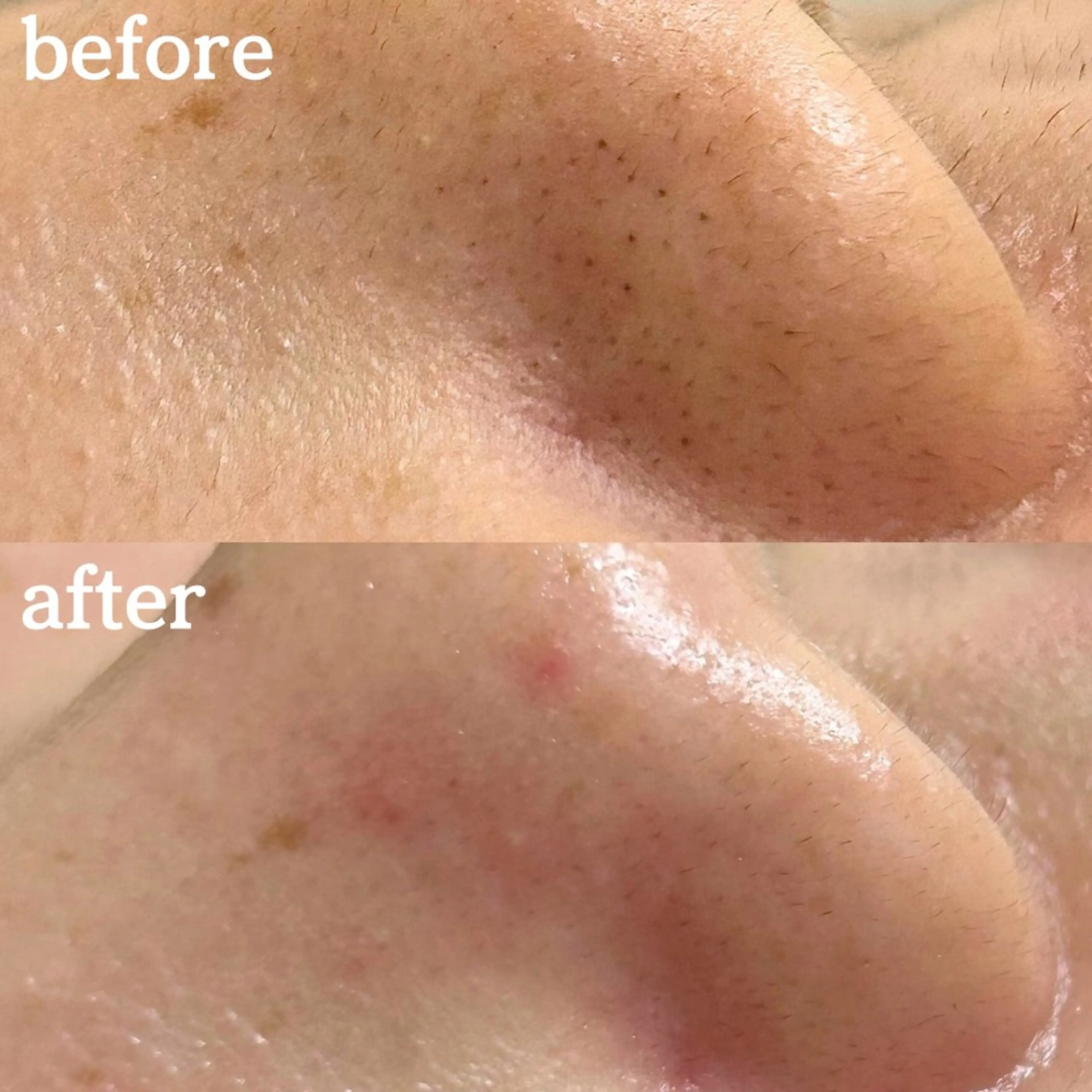 毛穴専門サロンLatiele所属・毛穴専門サロン Latieleのエステ・リラクイメージ