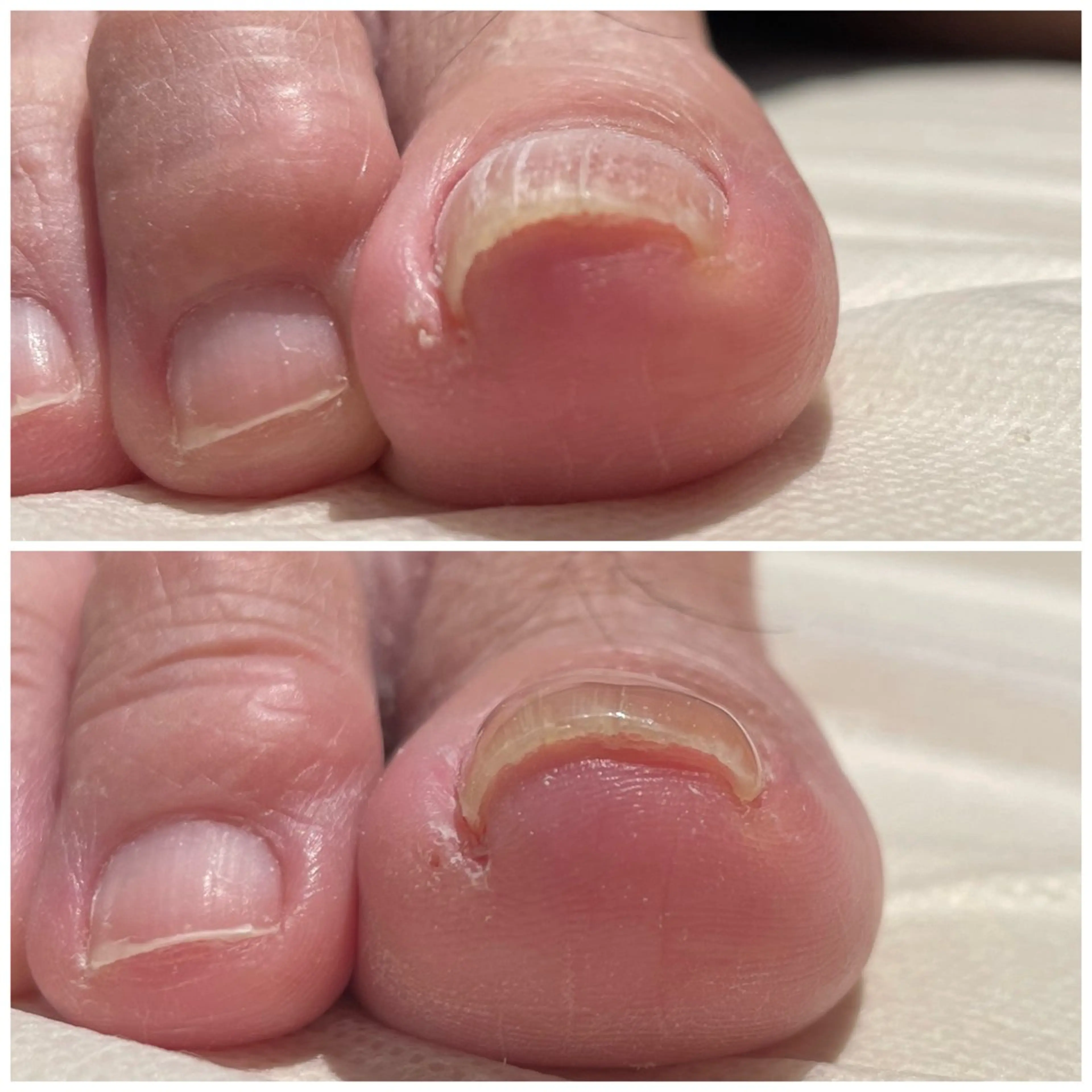 LIZERA&CO（charitesfam内）所属・南古谷　松本 かよのネイルデザイン