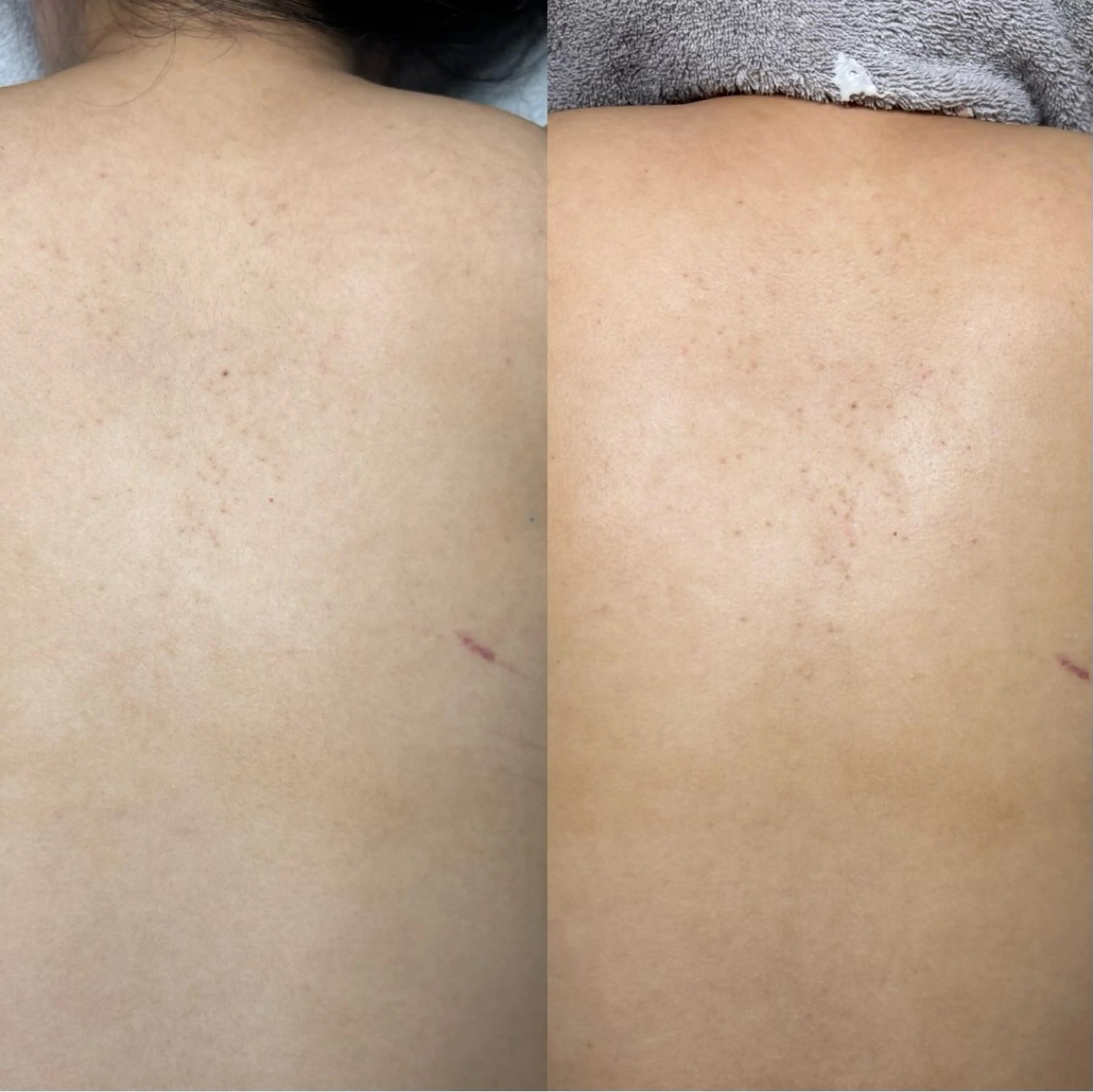 肌質改善サロンand...所属・肌質改善サロン and...のエステ・リラクイメージ