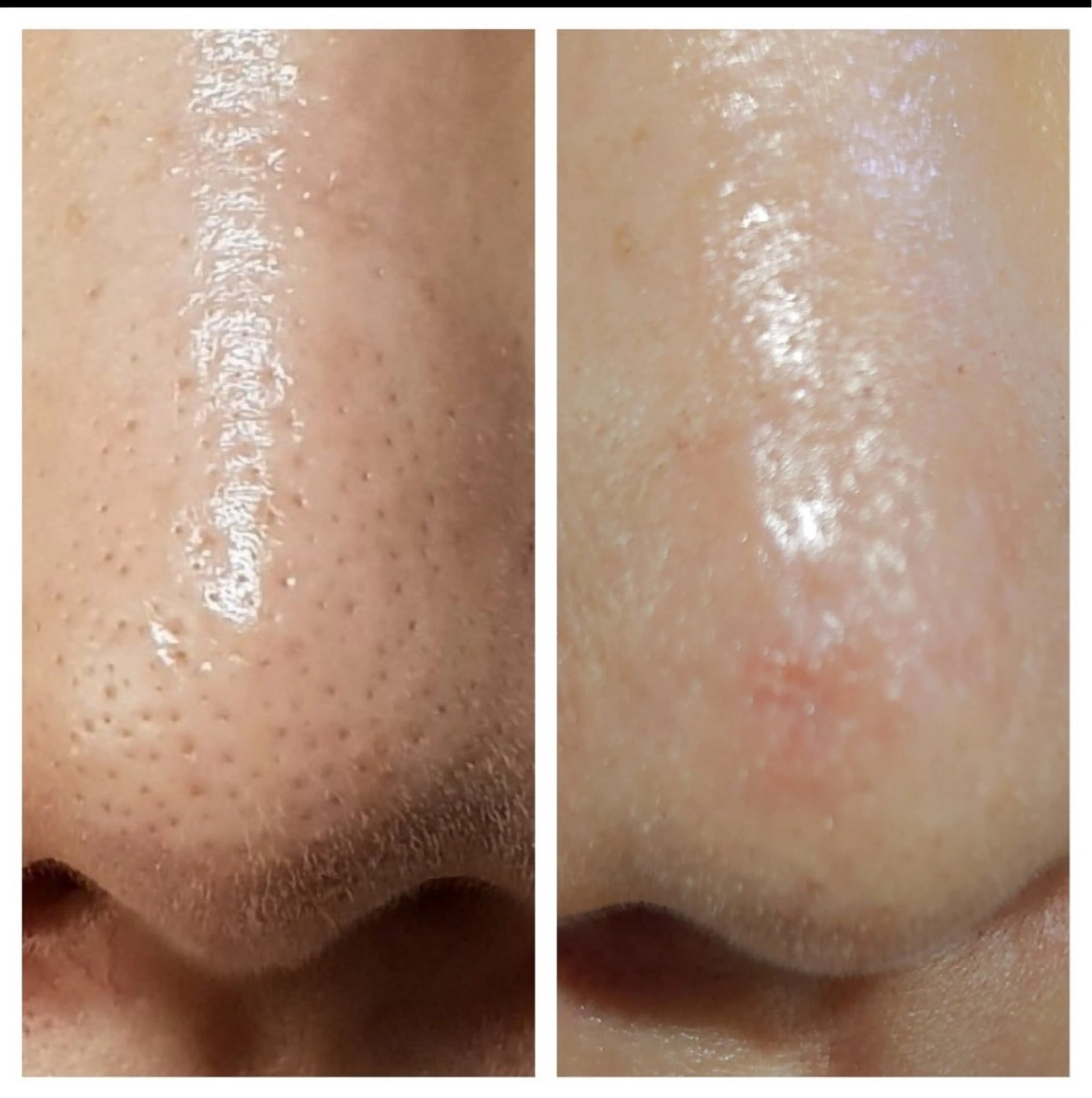 肌育専門ナース❗️ みのり／ナスサロのエステ・リラクイメージ