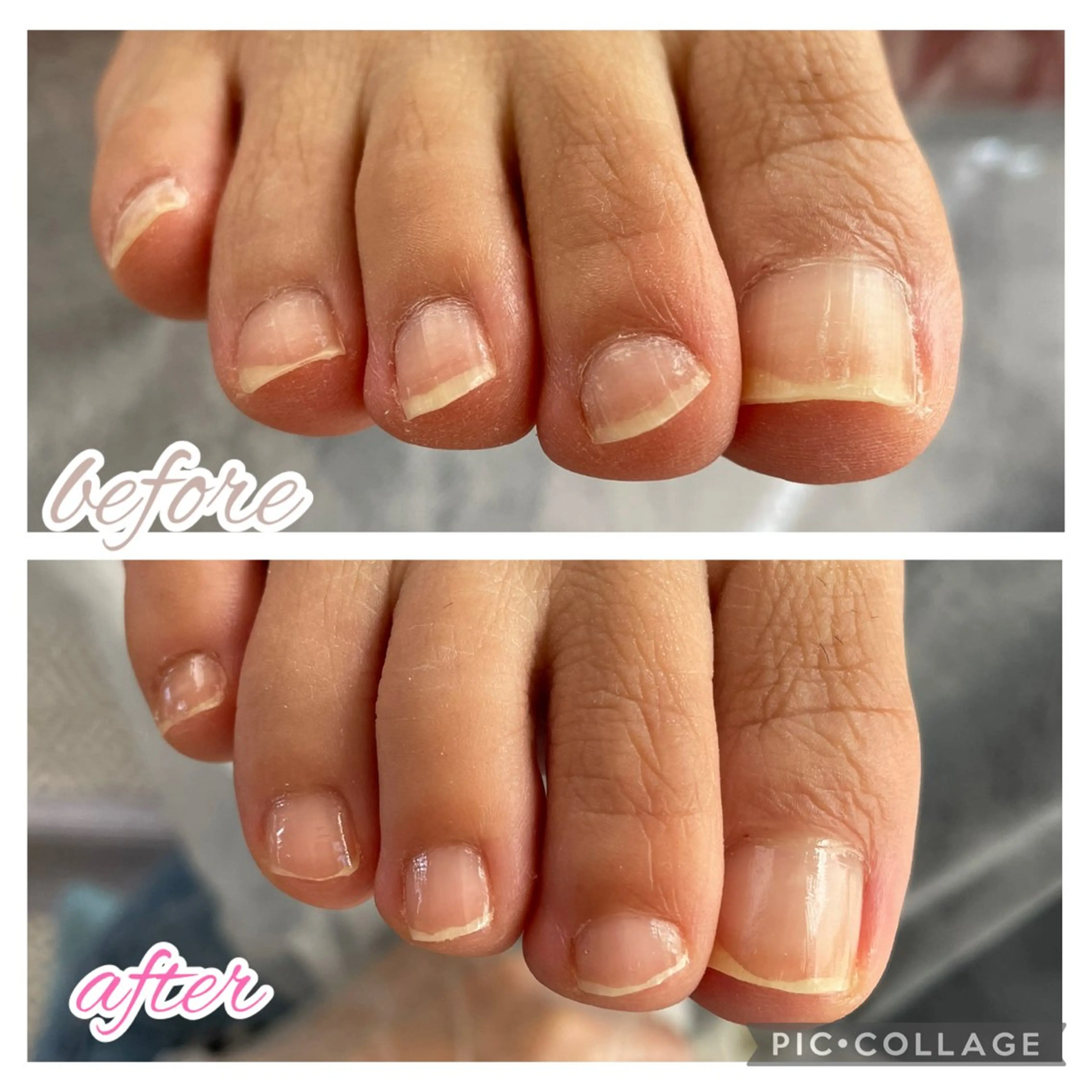 足爪ケアの写真