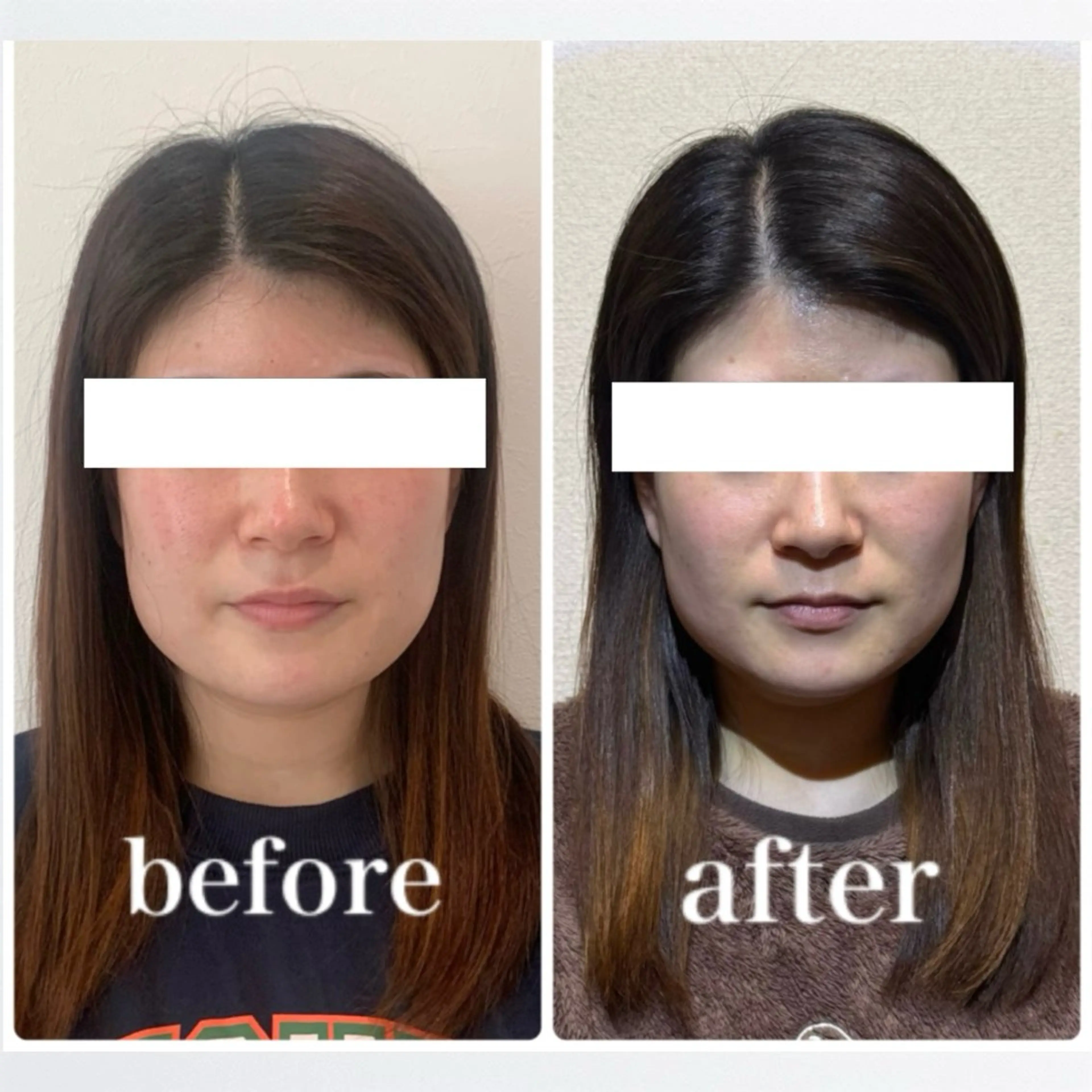 エステ リラク 小顔と ヘッドスパのお店のエステ・リラクイメージ