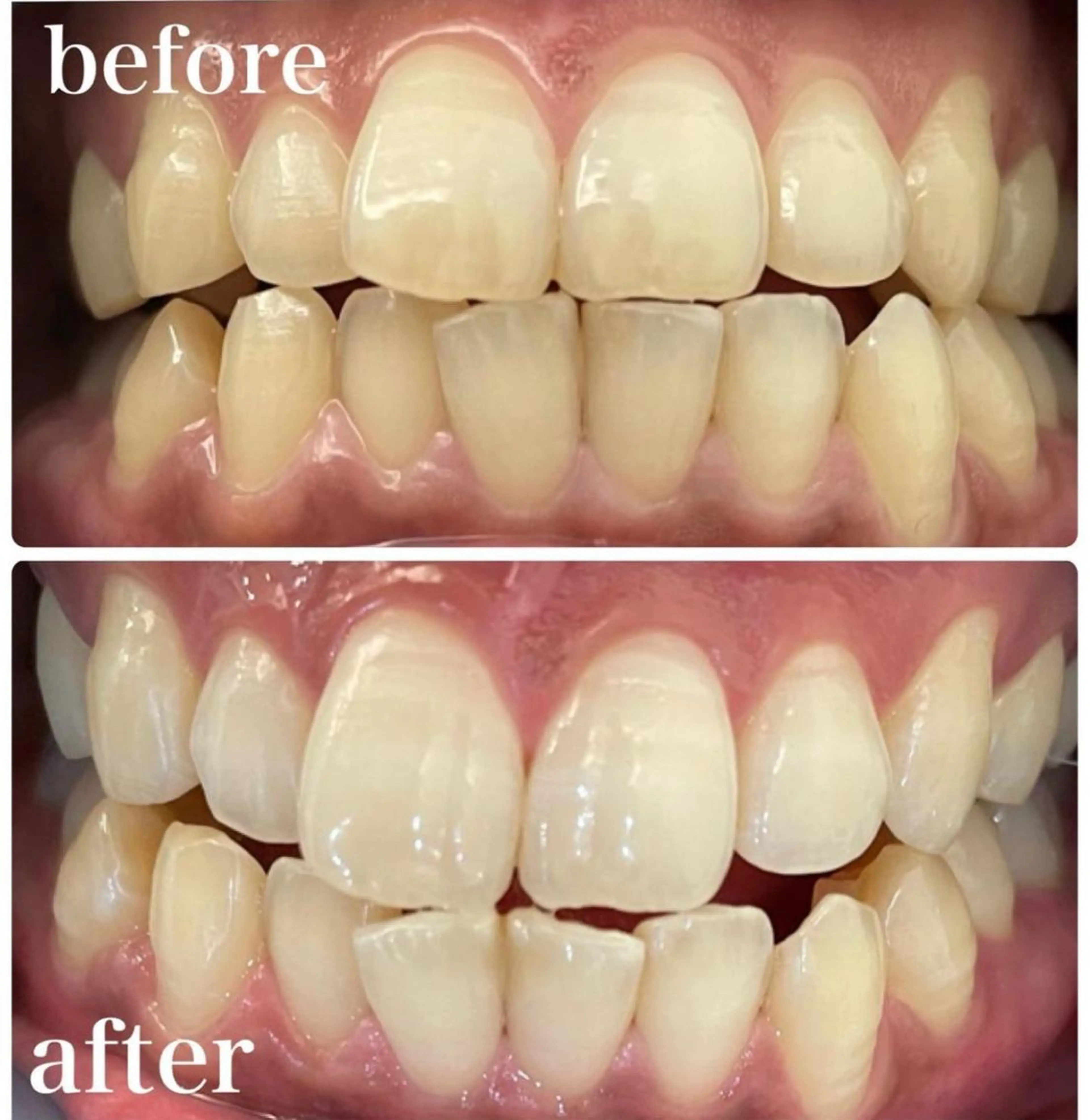 Ｃコース（12回）の写真