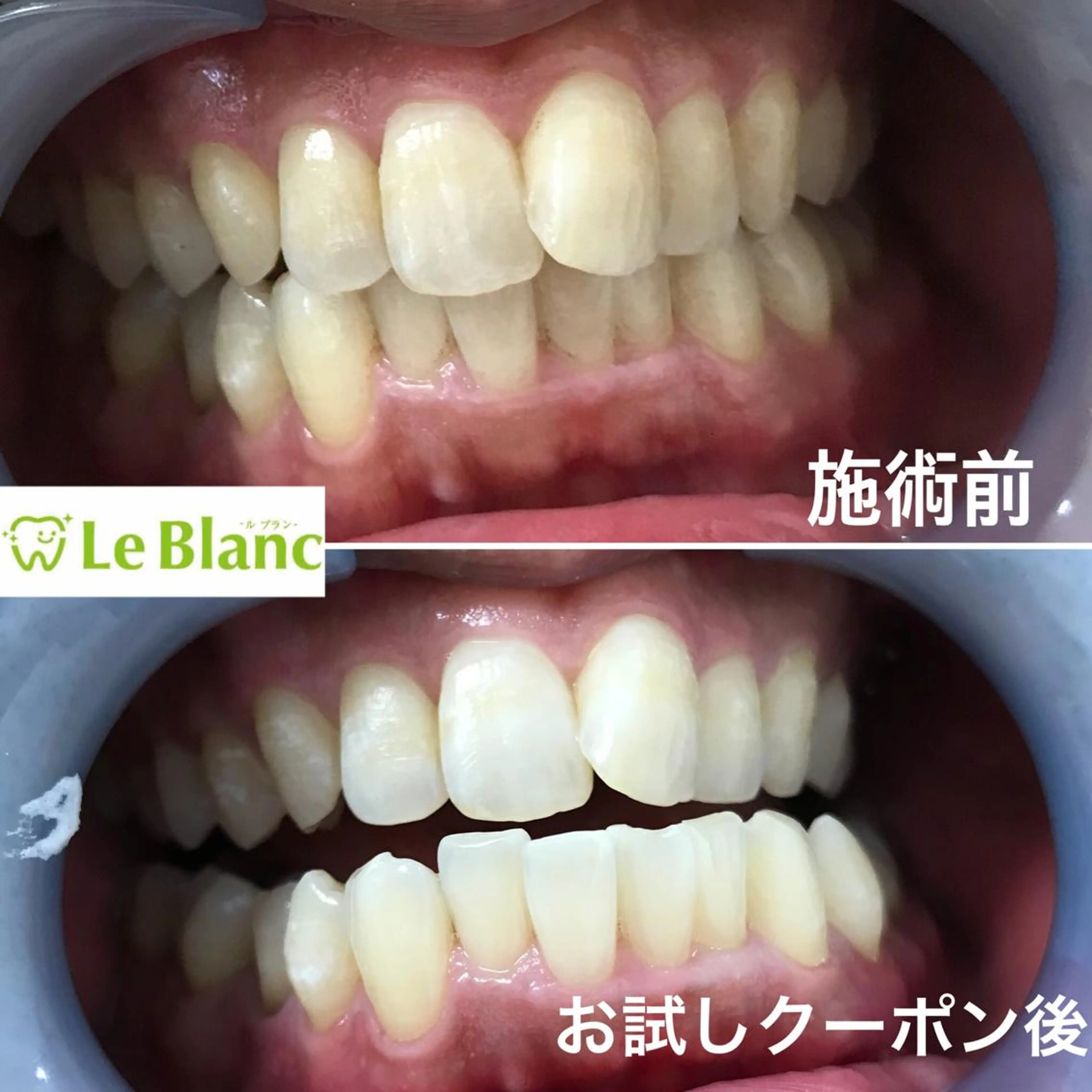 Le Blanc  奈良店のその他イメージ