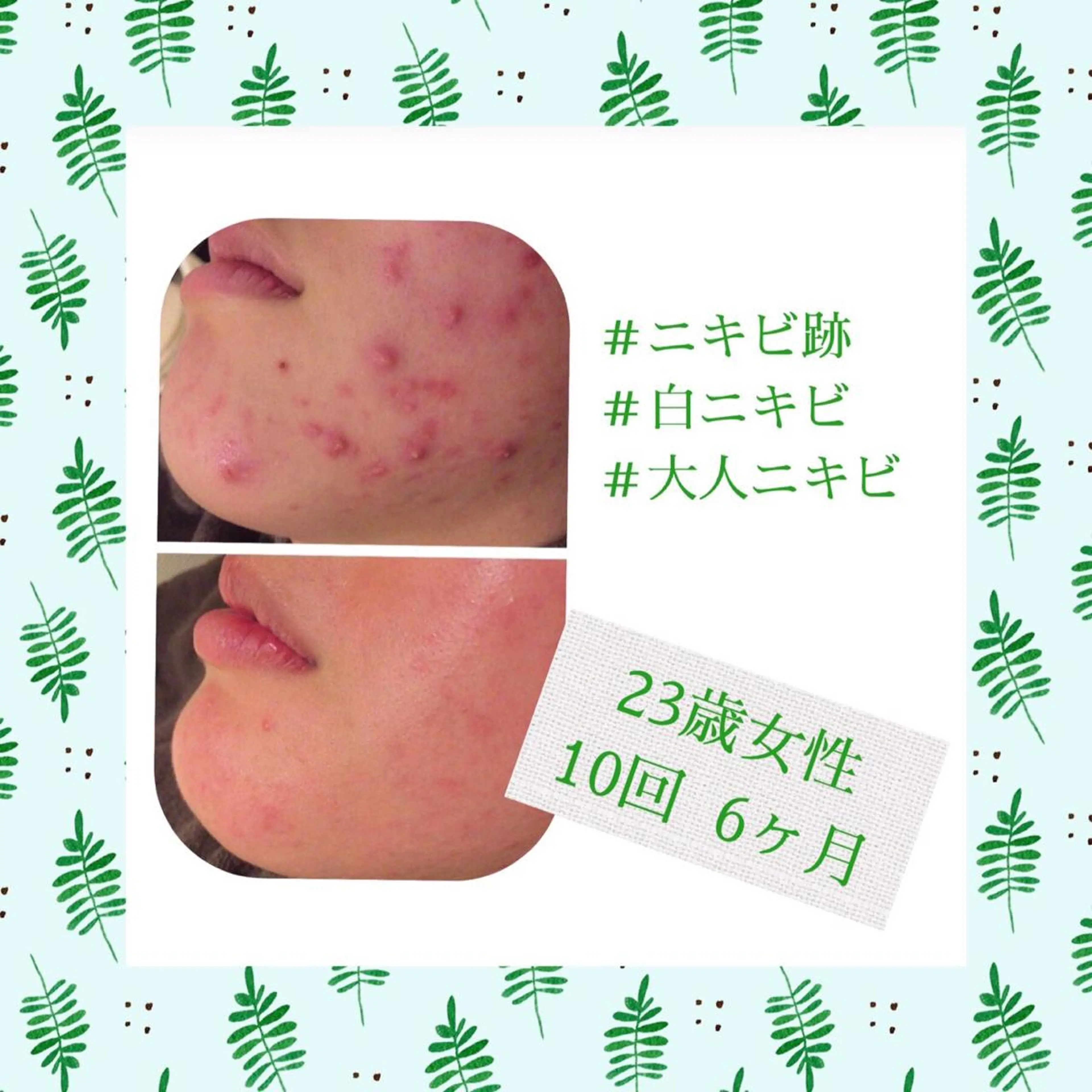 ミディアム カラー パーマ ヘアアレンジ メンズ キッズ ネイル マツエク・マツパ エステ リラク ニキビ・肌質改善専門 ♡人生が変わるサロンのエステ・リラクイメージ