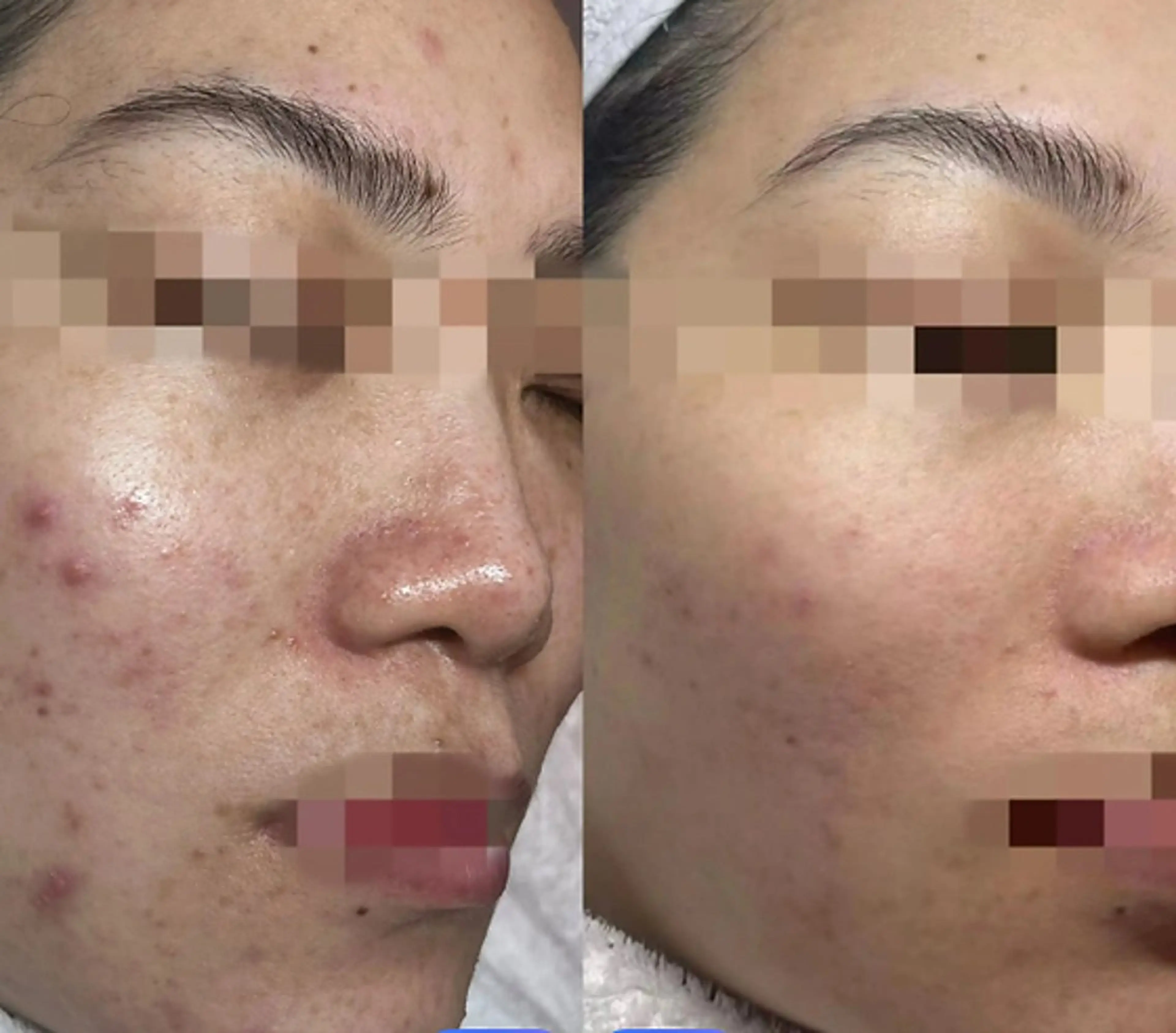 エステ セルフエステ ALL in ONE所属・1組貸切 セルフエステのエステ・リラクイメージ