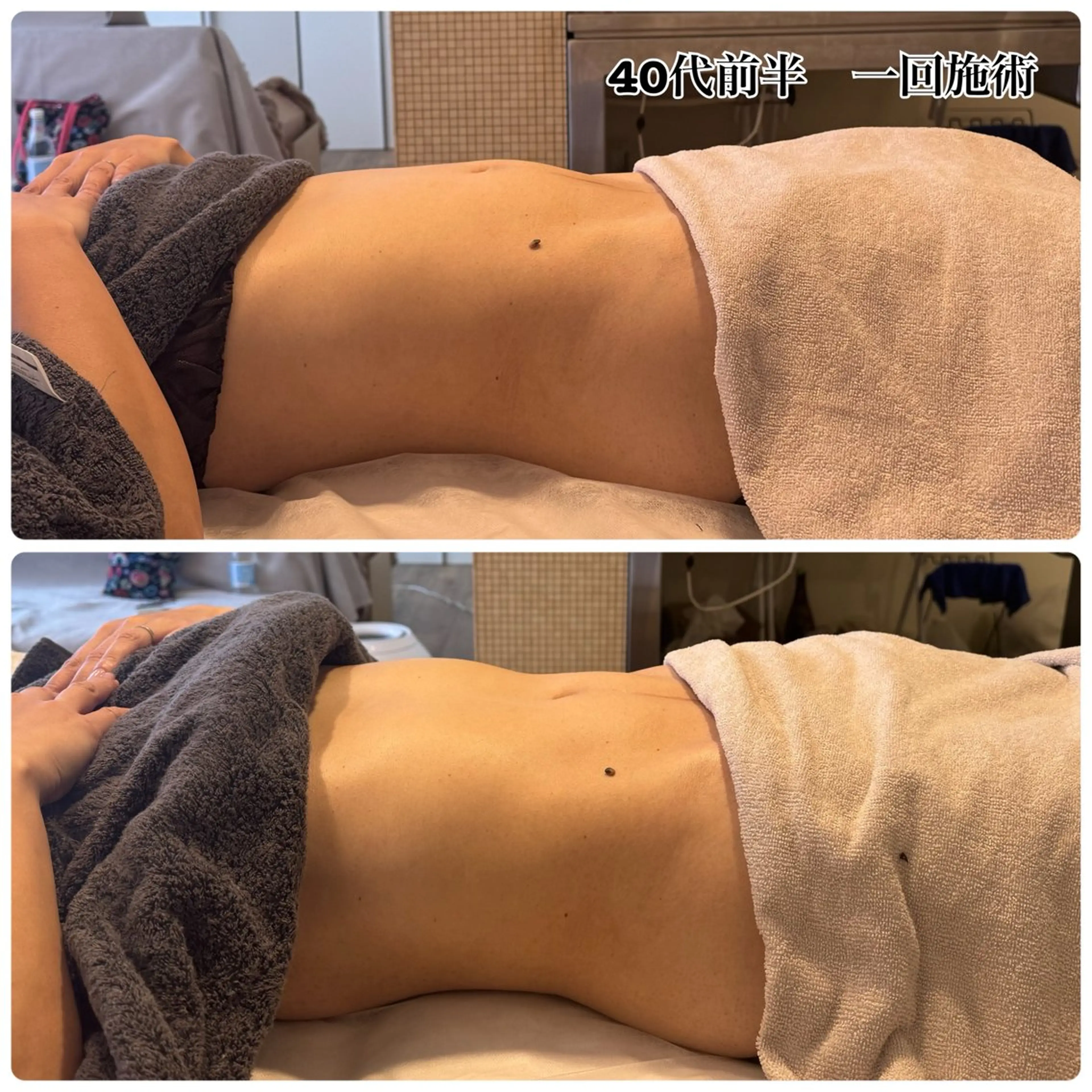 今話題❗️ウエストくびれ◎骨盤から整える腸もみの写真