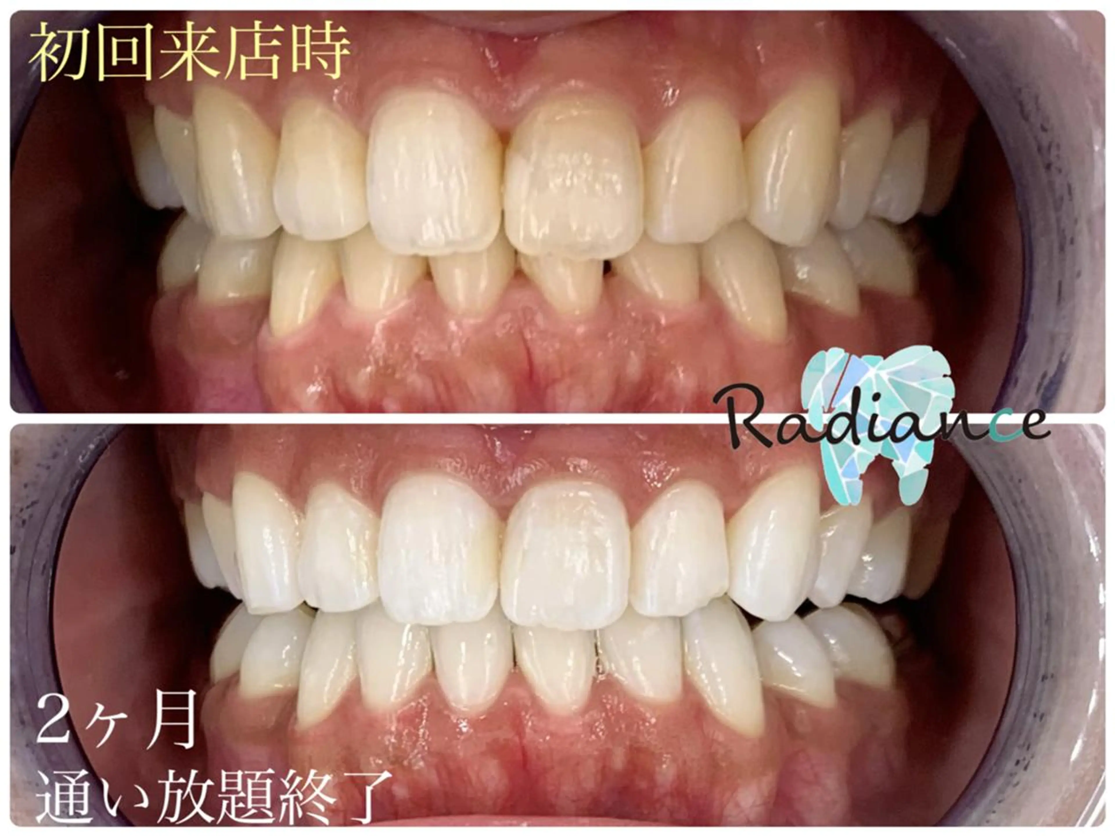 札幌ホワイトニング ラディアンス菊水店のその他イメージ