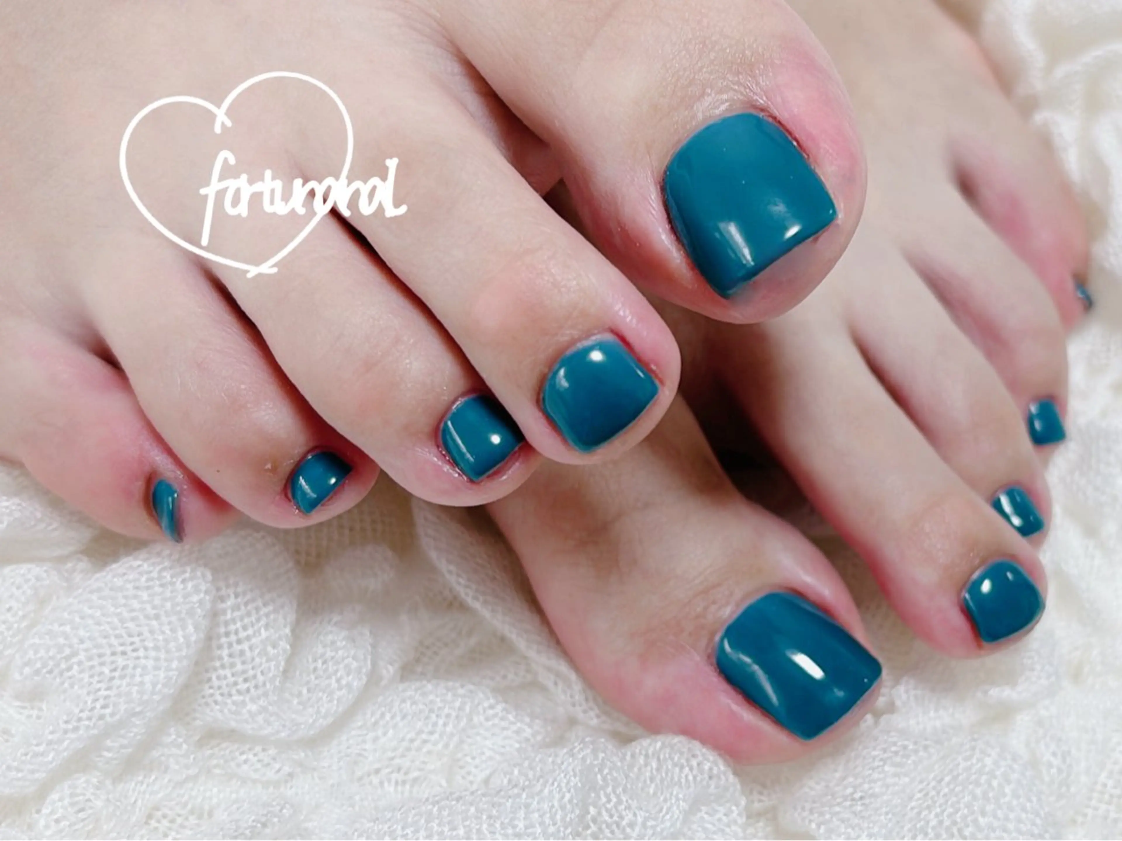 ネイル フットネイル Nail •Head スパFortunaのネイルデザイン