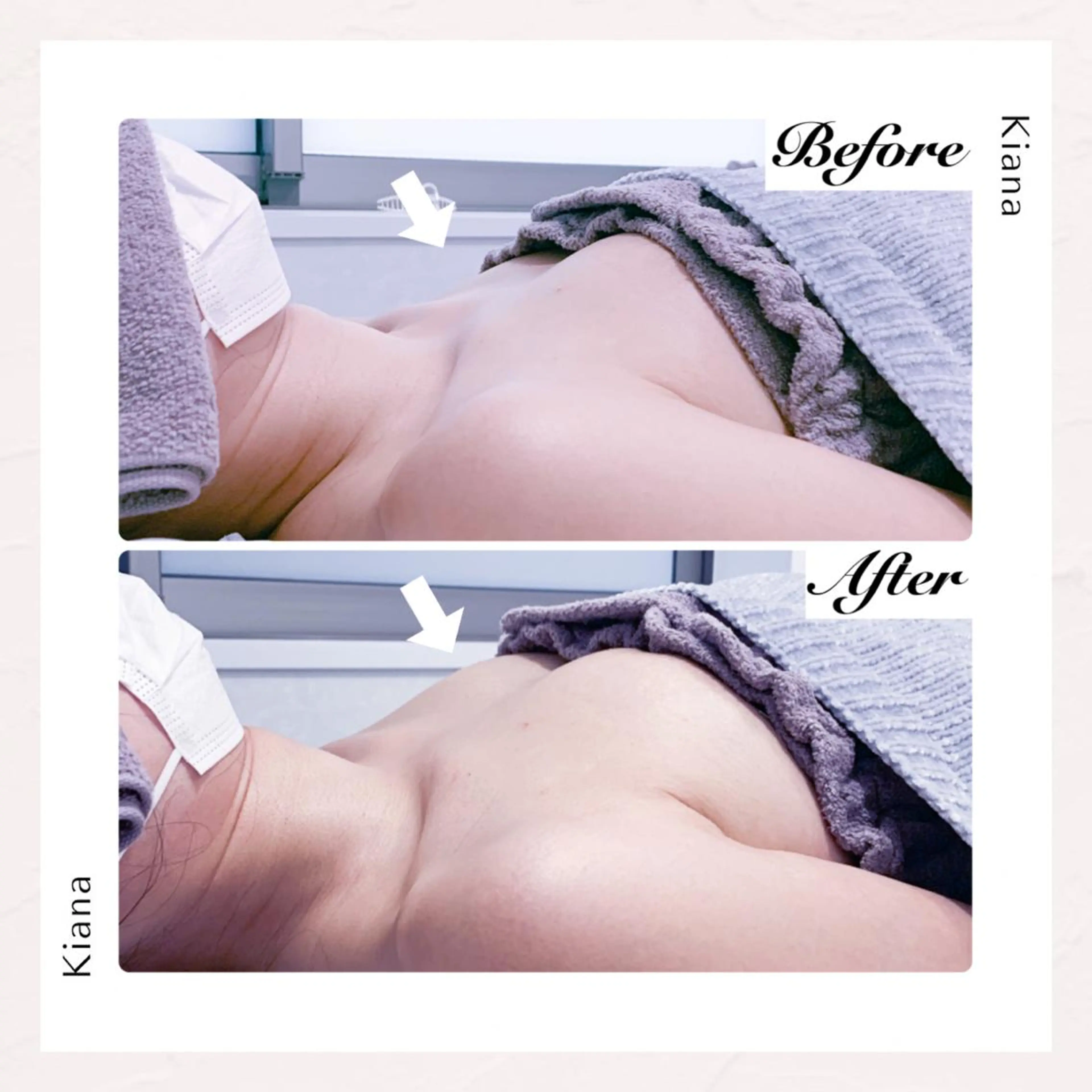 バスト専門Kiana 風のエステ・リラクイメージ