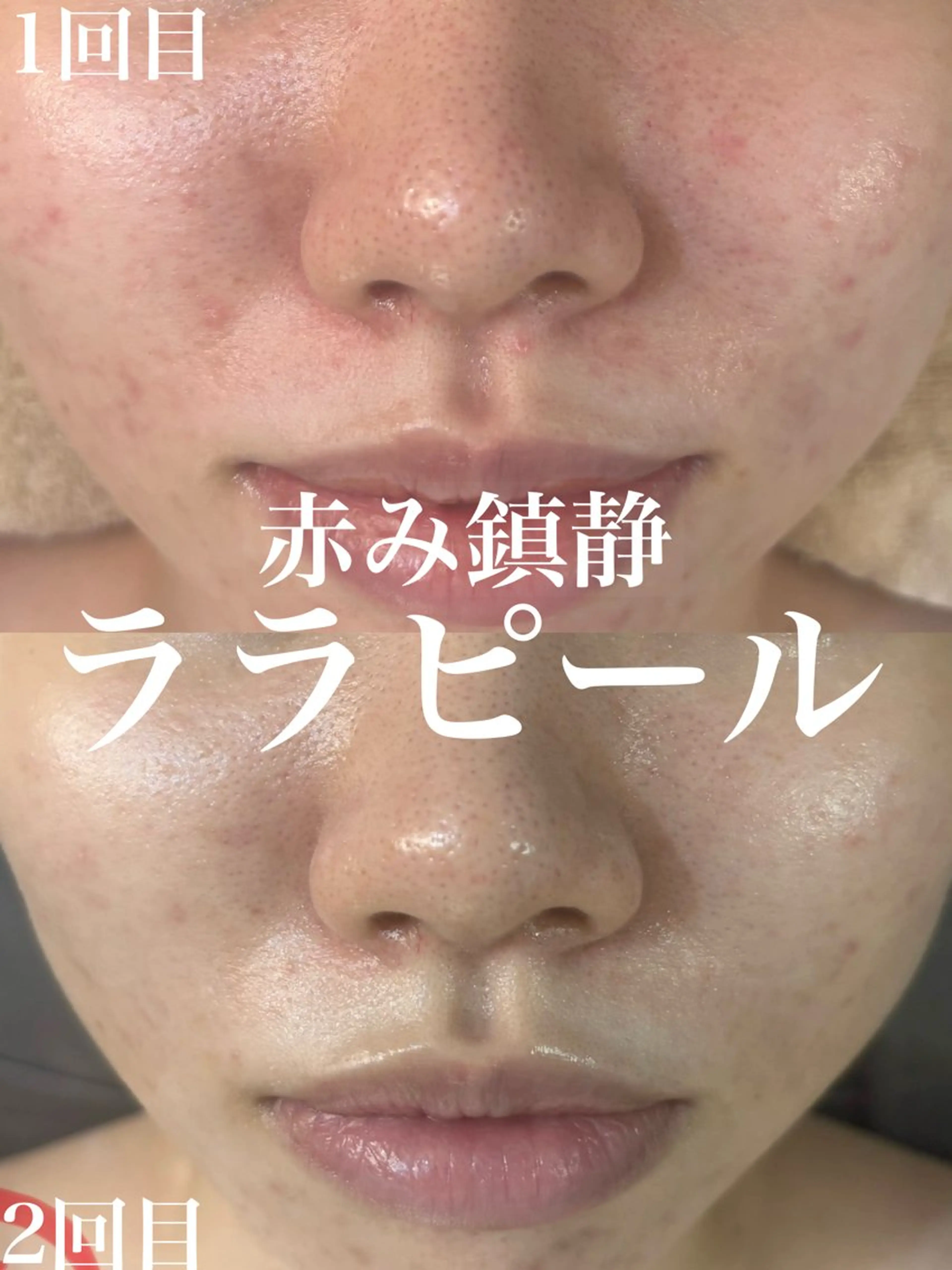 エステ WHITE AQUA 北千住店のエステ・リラクイメージ