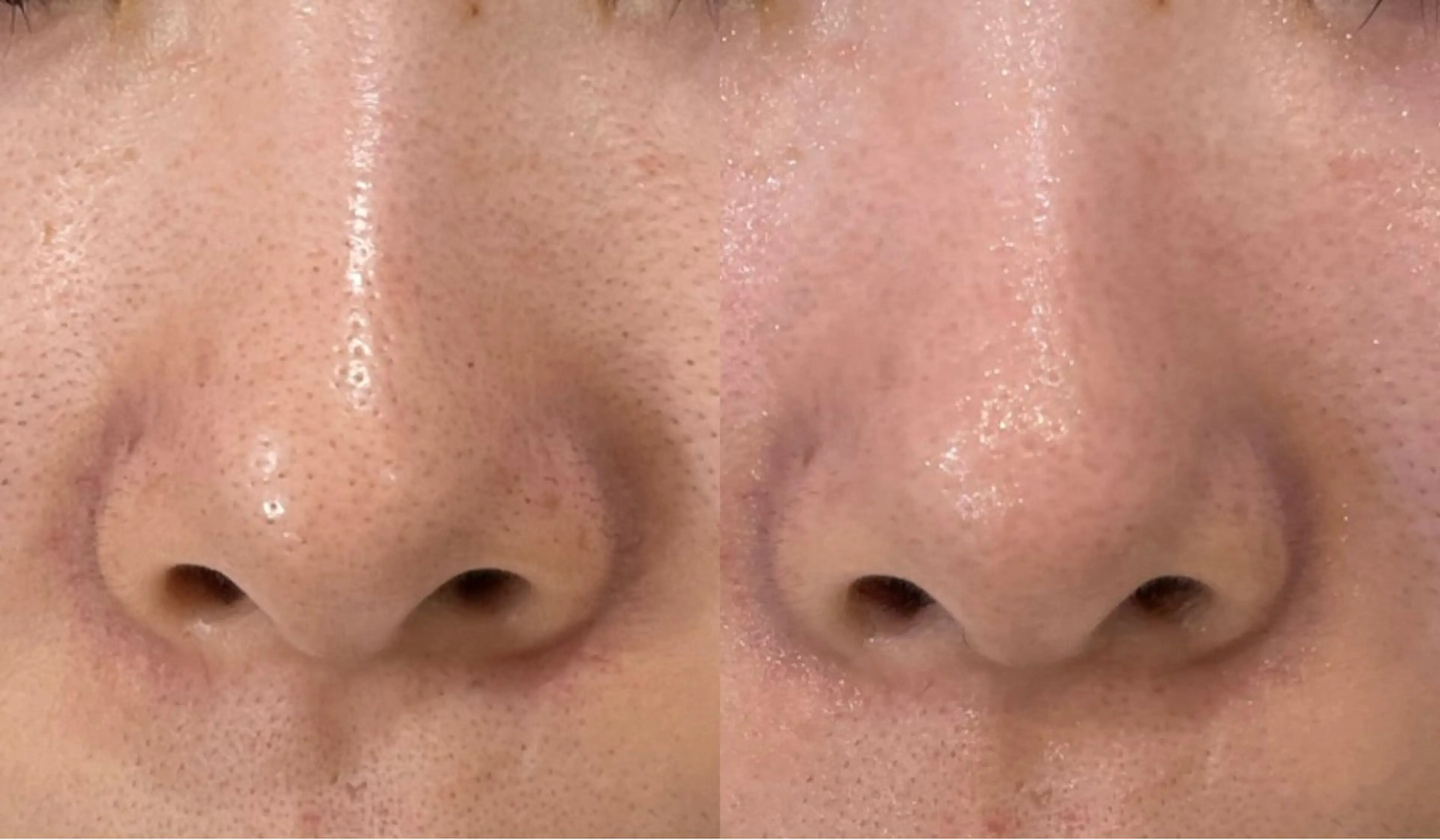 エステ DeI'm   名古屋栄所属・小林 玲菜のエステ・リラクイメージ