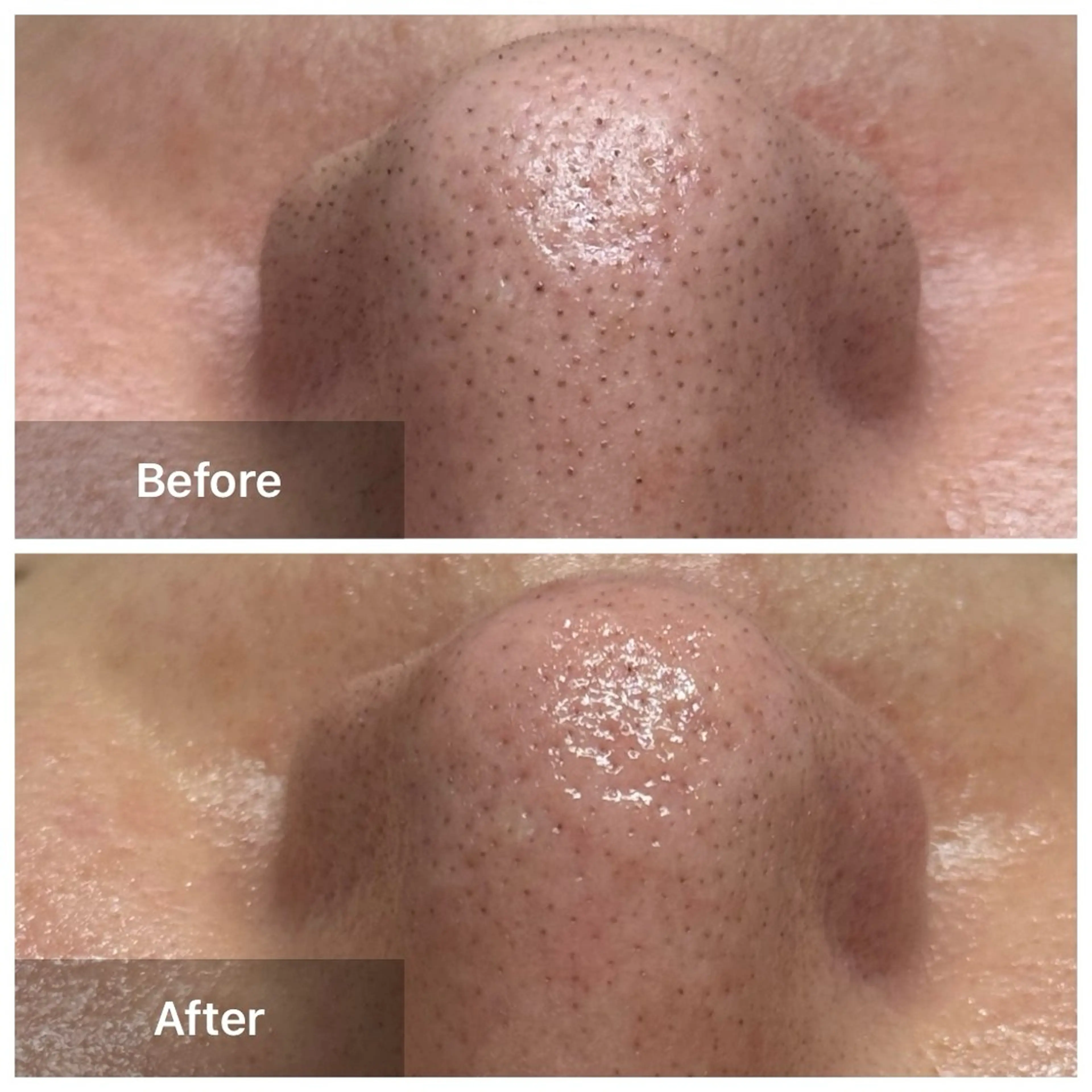 エステ Beauty salon LUNA所属・LUNA / Sakikoの眉毛・アイブロウイメージ