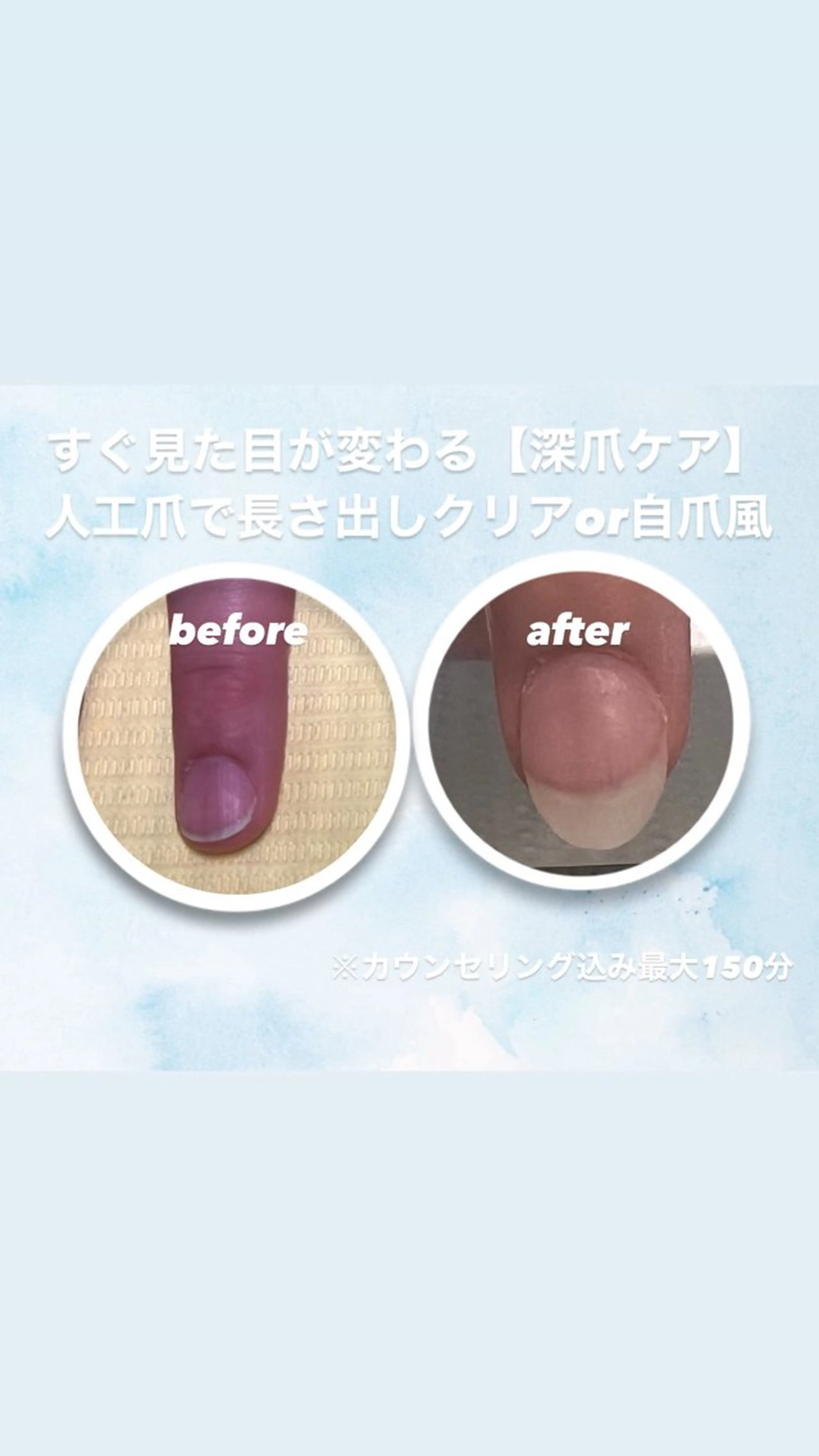 メンズ ネイル ハンドネイル 爪ケア/深爪 自爪育成 🐰えむのネイルデザイン