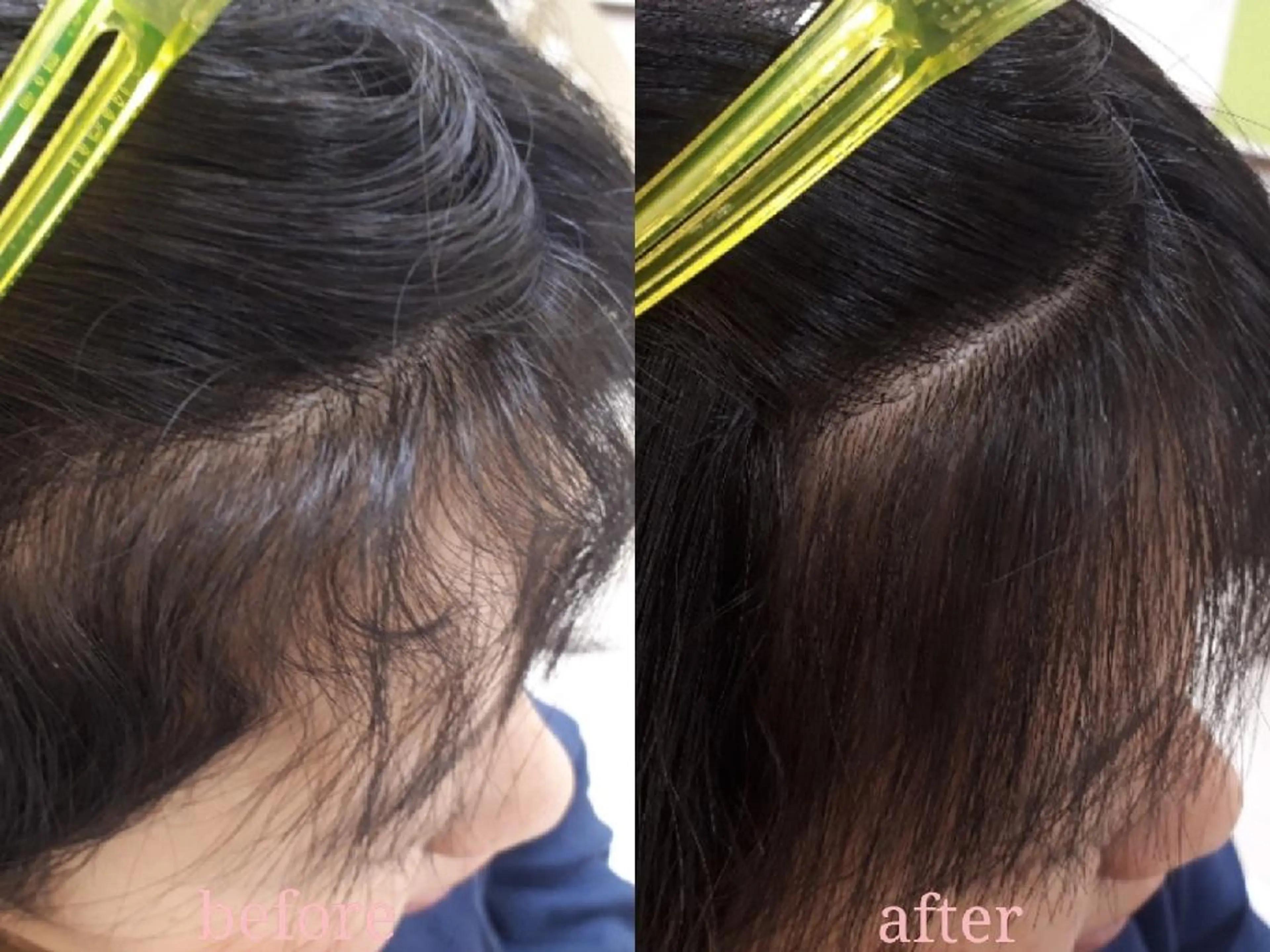 ミディアム くせ毛 縮毛矯正 SALOWIN神戸三宮所属・山崎 美奈のヘアスタイル