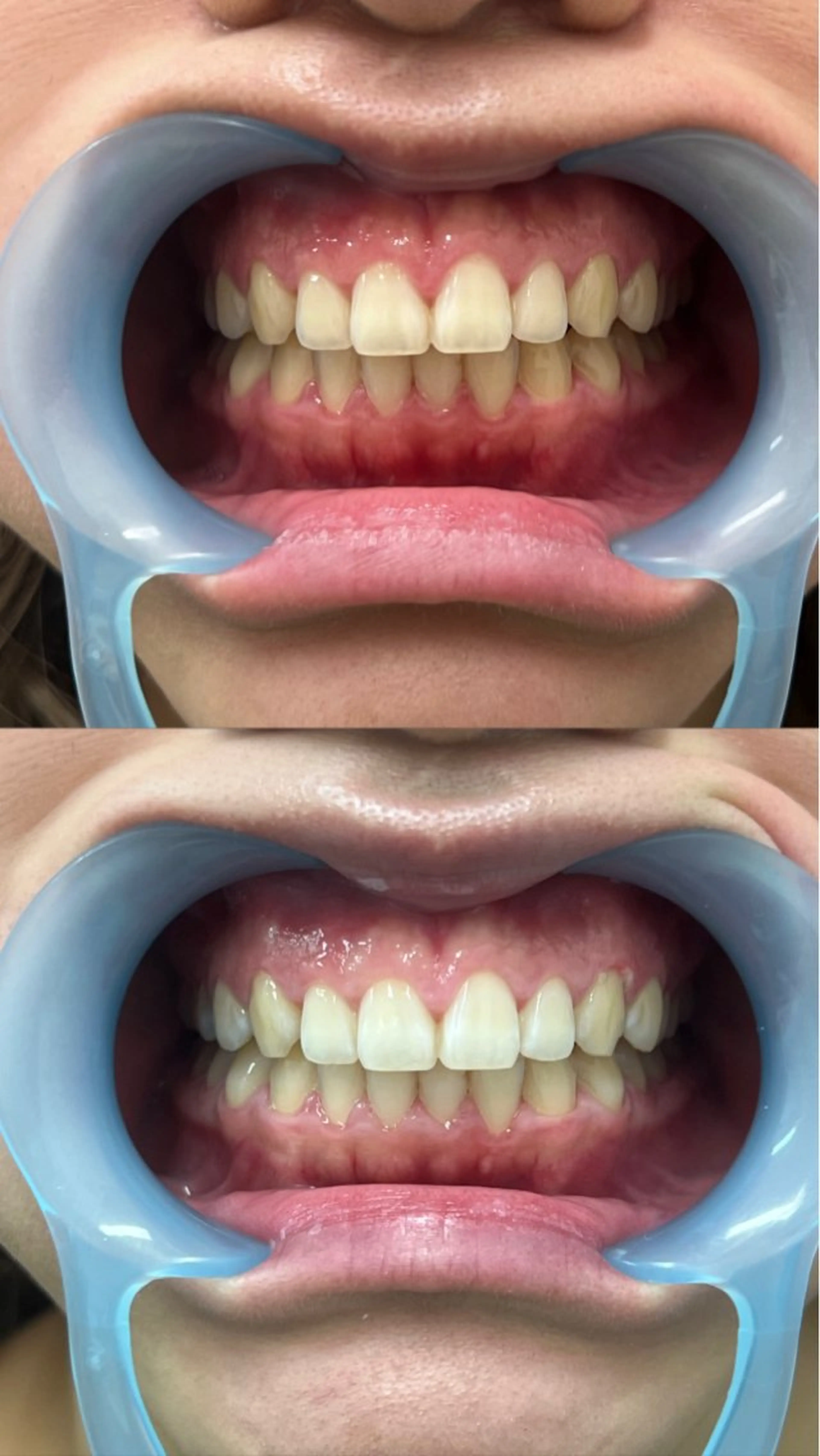 Amaranth所属・Lupinus 小顔矯正のエステ・リラクイメージ