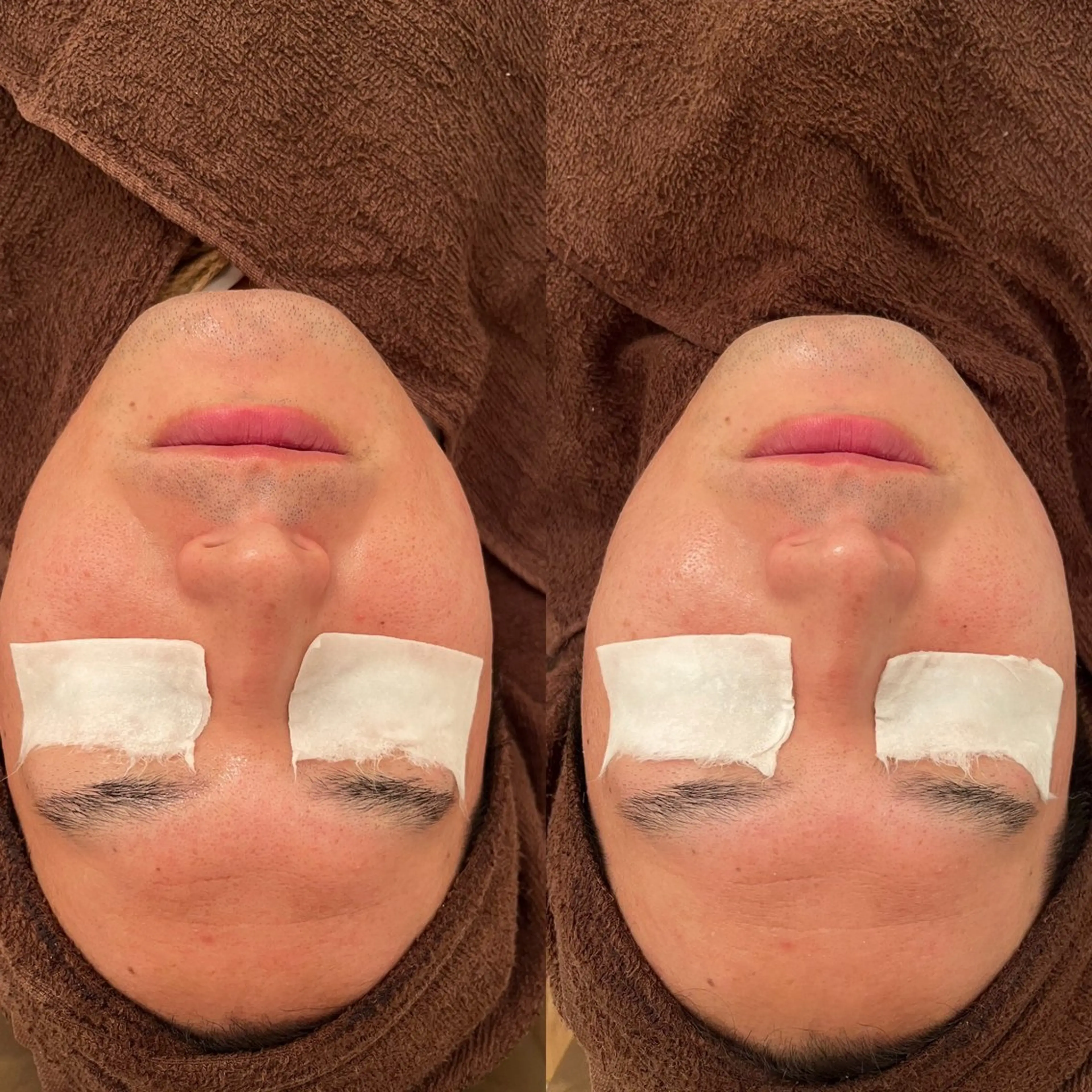 メンズ 毛穴ケア/毛穴診断/ 毛穴洗浄〔心斎橋〕のエステ・リラクイメージ