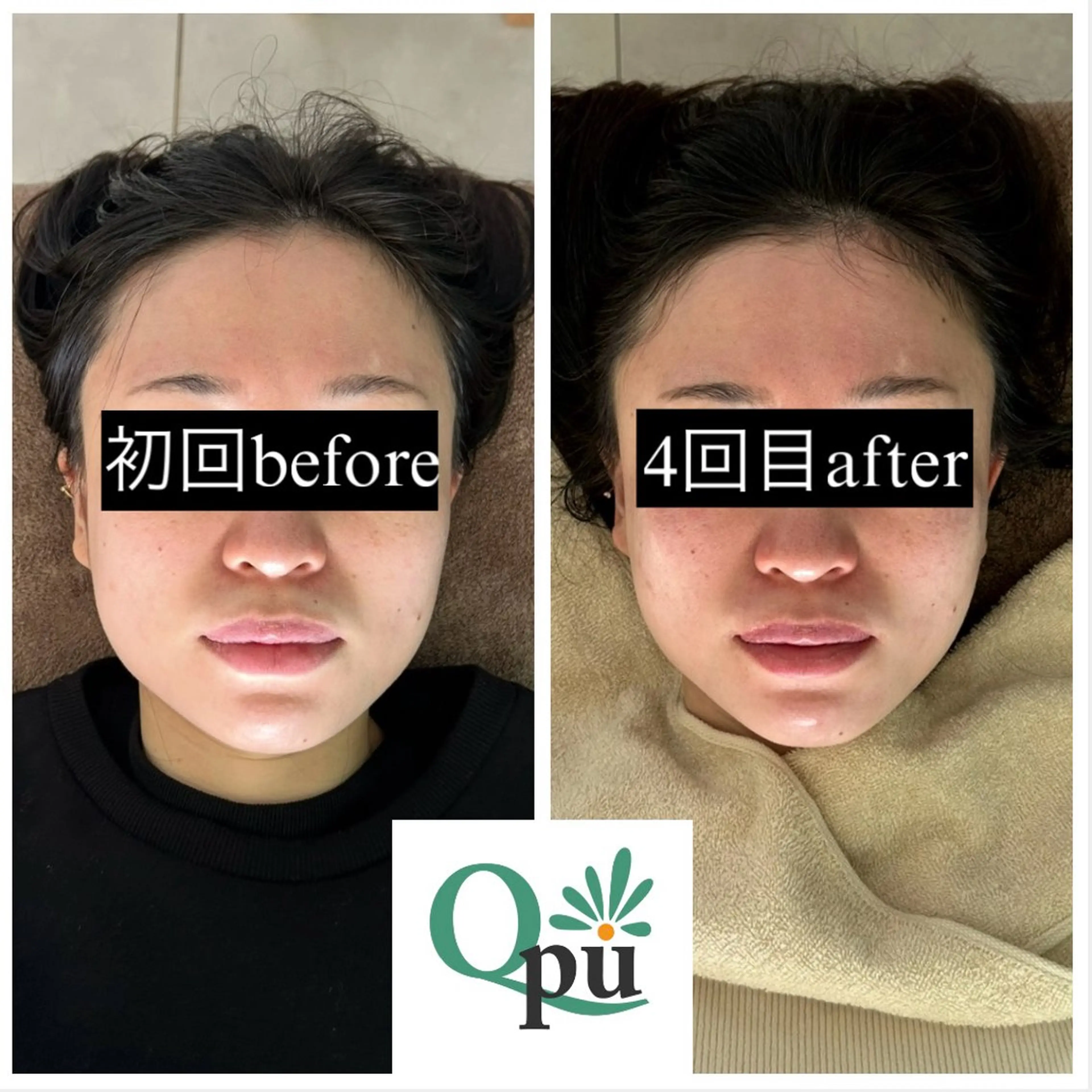 Qpu(キュープ)下北沢店所属・鮎川 さゆりのエステ・リラクイメージ