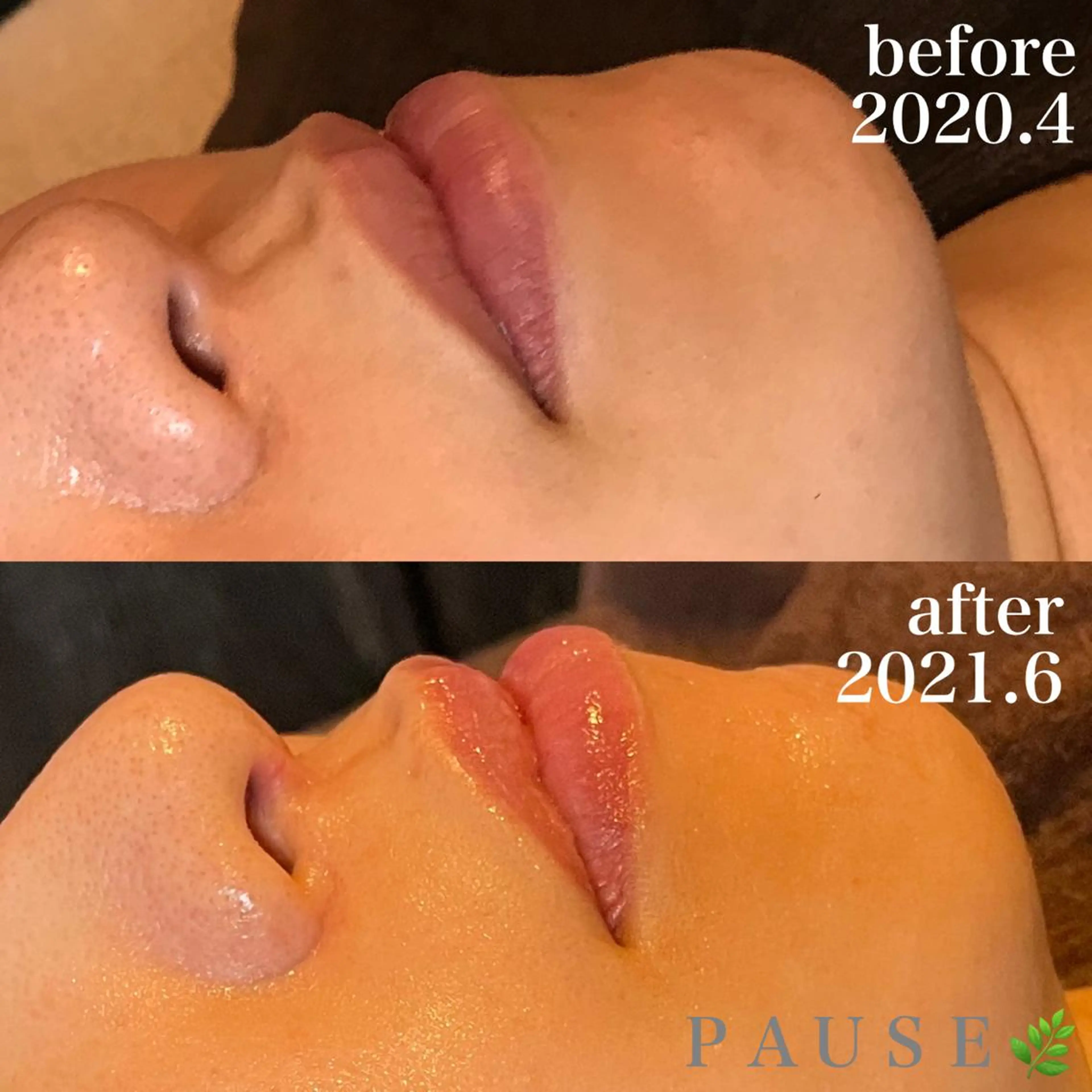 エステ 浜野 恵美のエステ・リラクイメージ