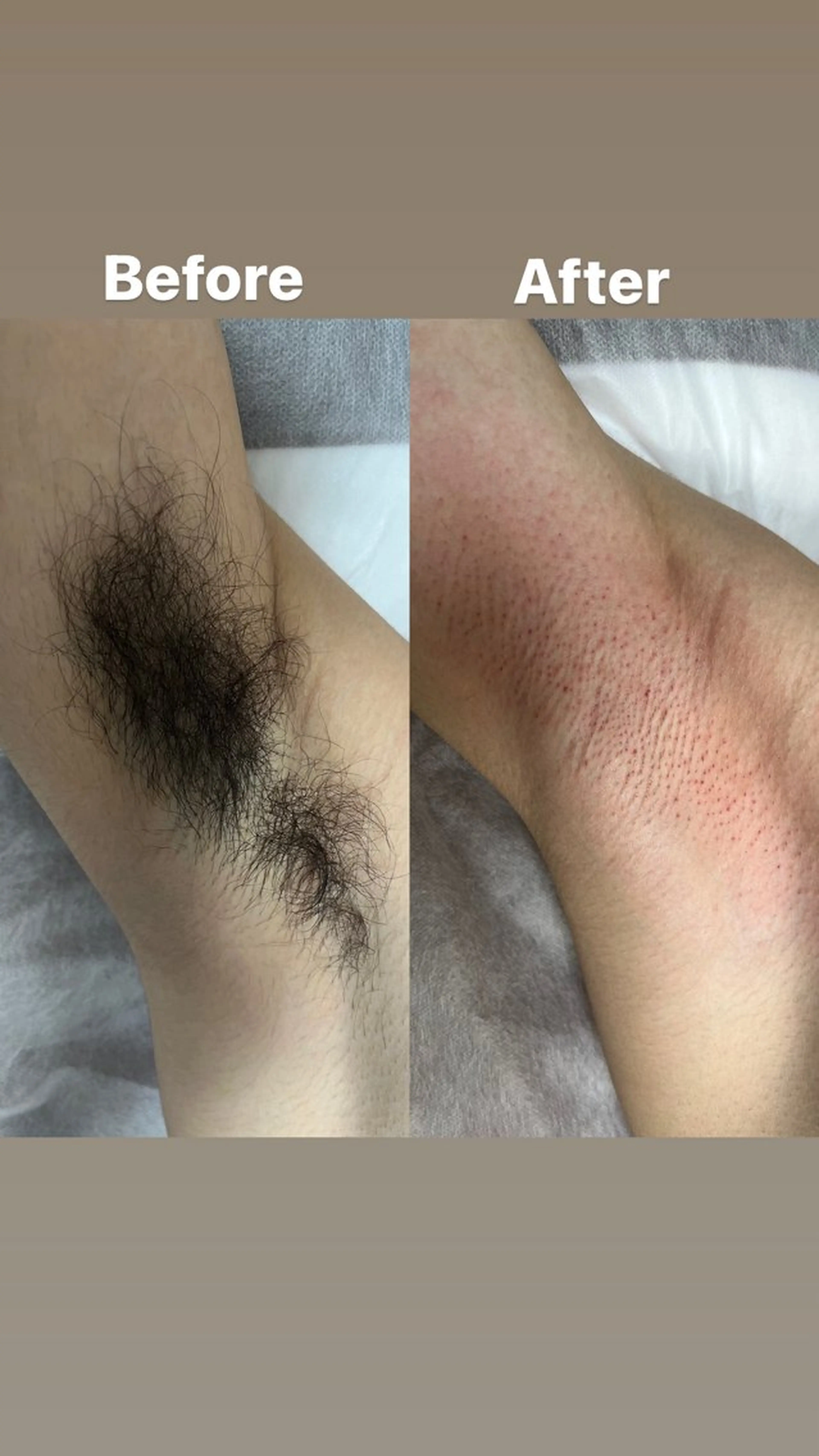 🌿両脇ワックス🌿【女性】¥3,000【男性】¥4,500の写真