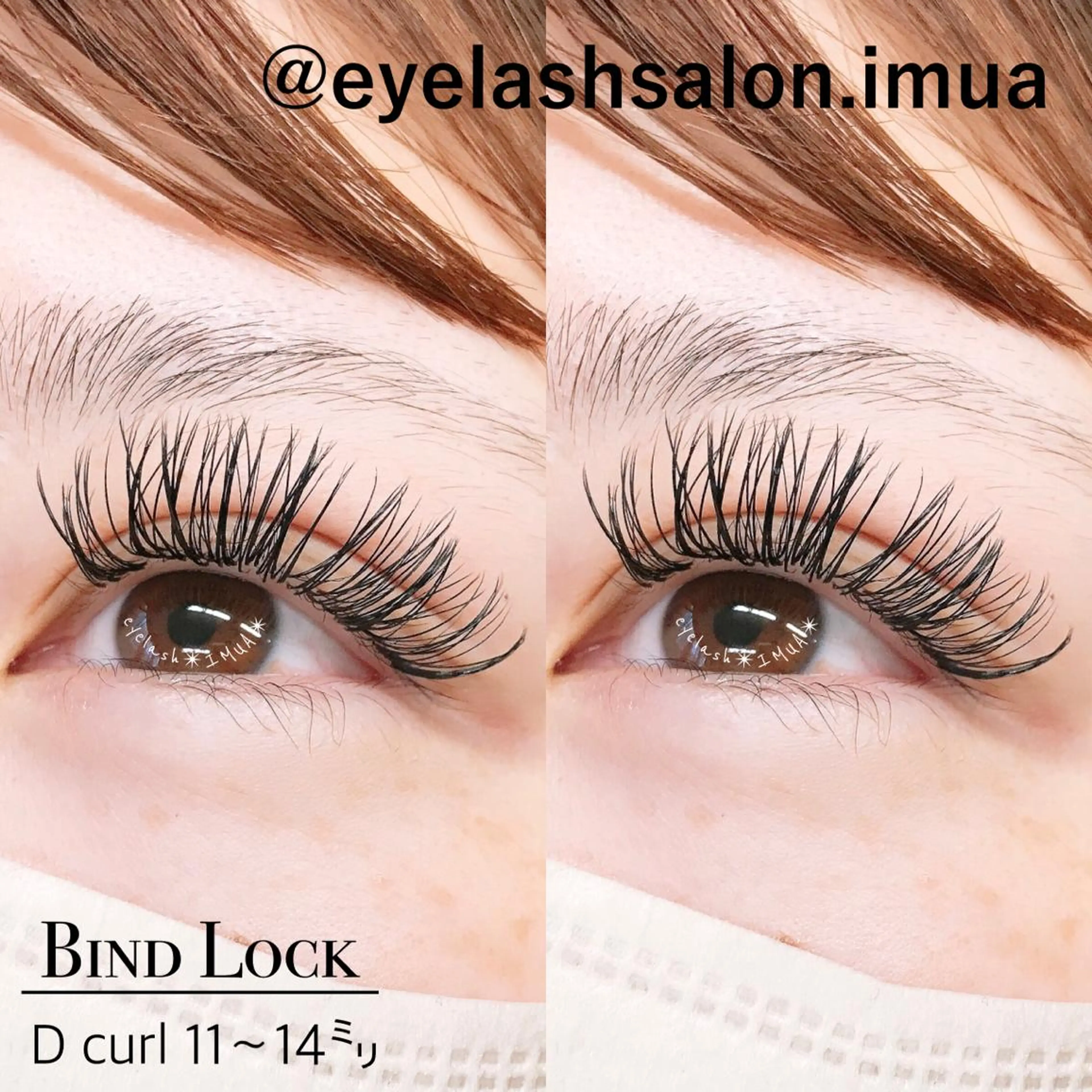 最新技術　バインドロック120束【コーティング込み】の写真