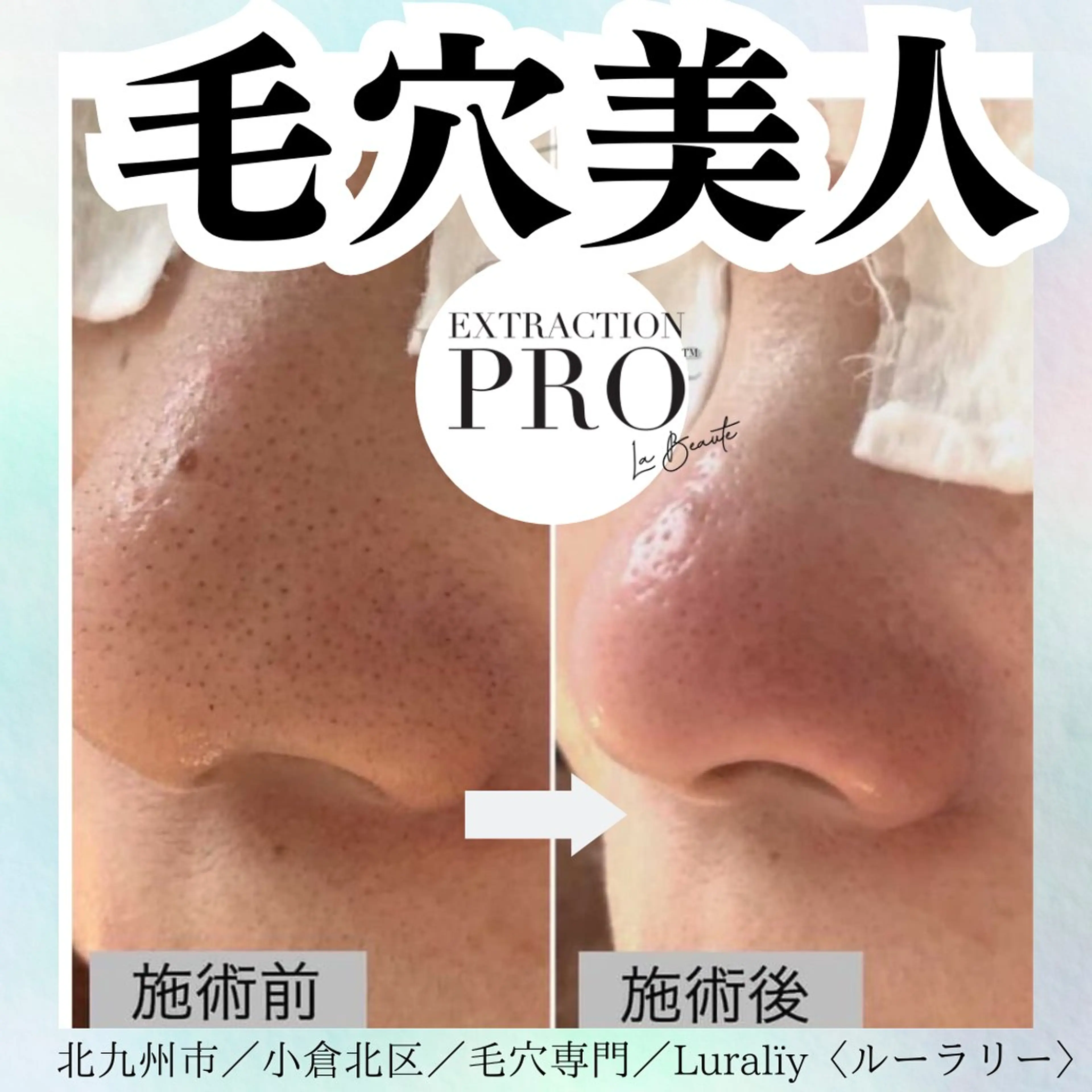 毛穴美人コースの写真