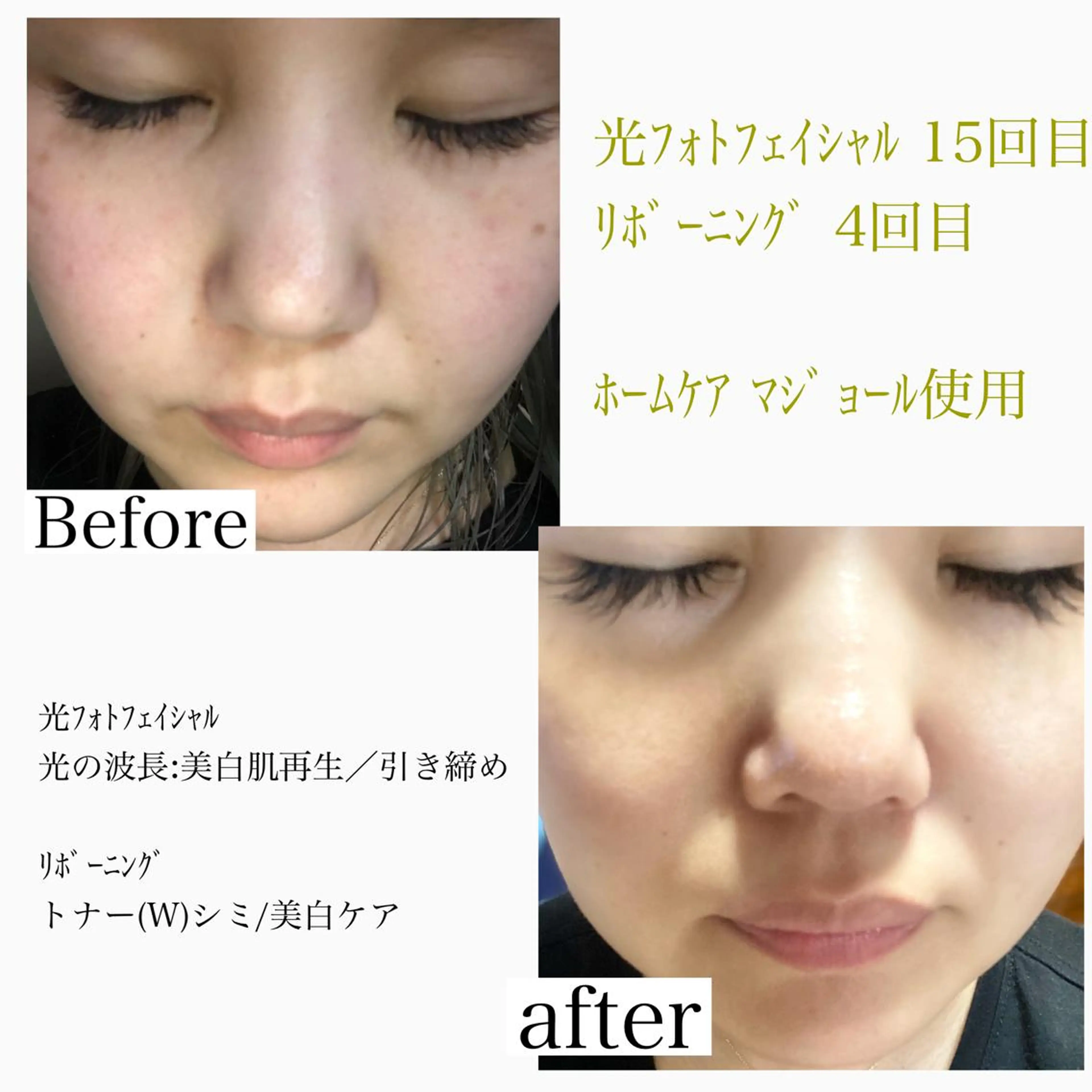 美肌脱毛と癒しのﾌﾟﾗｲﾍﾞｰﾄｻﾛﾝ。gratia~ｸﾞﾚｲﾃｨｱ~所属・gratia ~ｸﾞﾚｲﾃｨｱ~のエステ・リラクイメージ