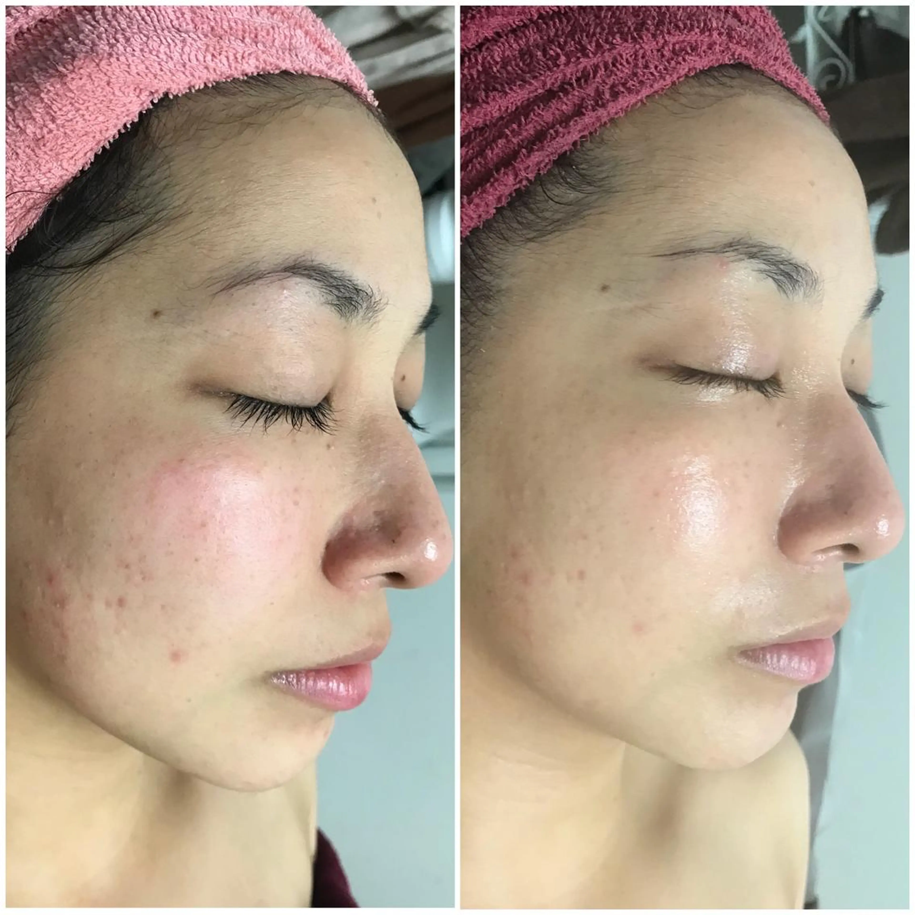 高速脱毛エステ リアンのエステ・リラクイメージ