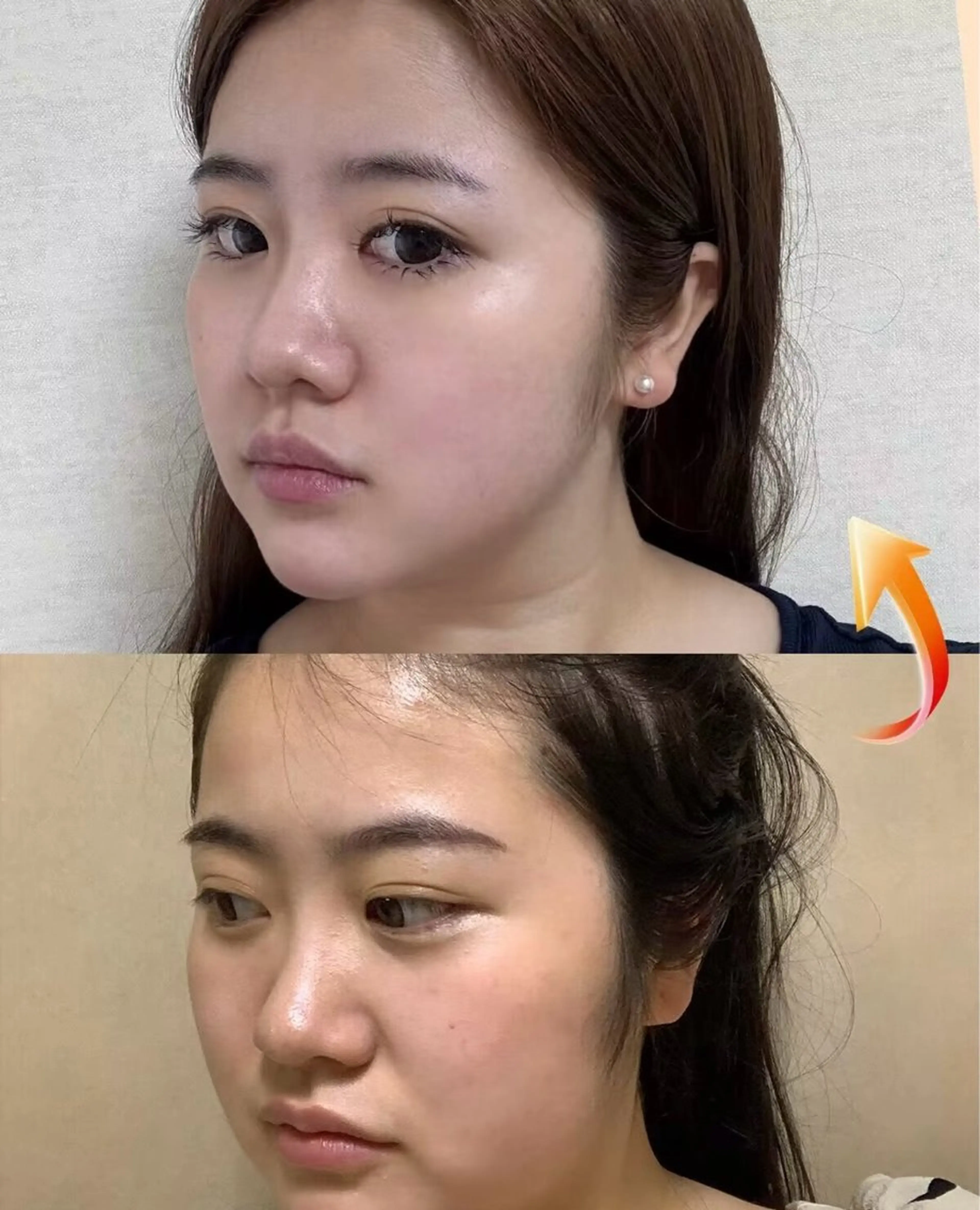 マツエク・マツパ エステ aliaハイフ&水光ジェットサロン所属・aliaハーブ水光店 エステティシャン募集のエステ・リラクイメージ